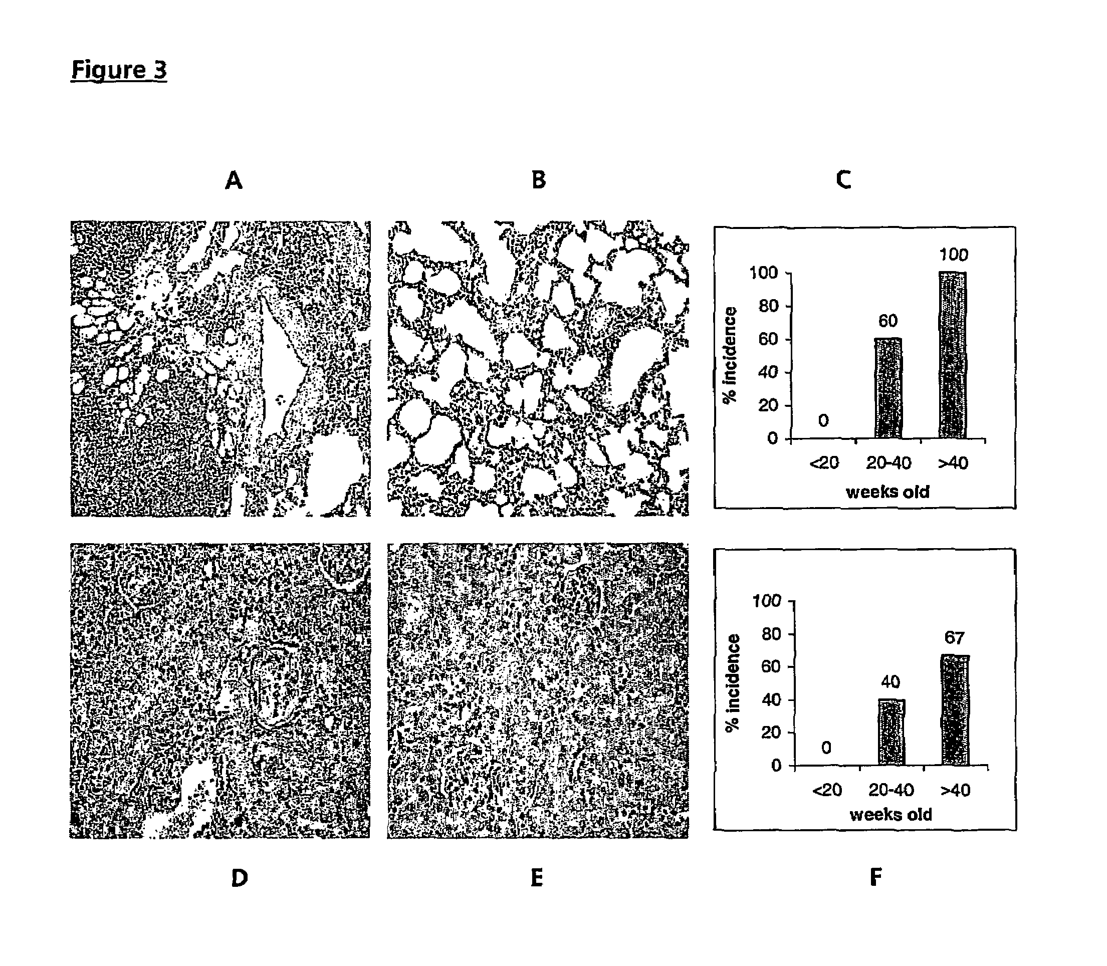 FcγRIIa transgenic animal model for autoimmune disease