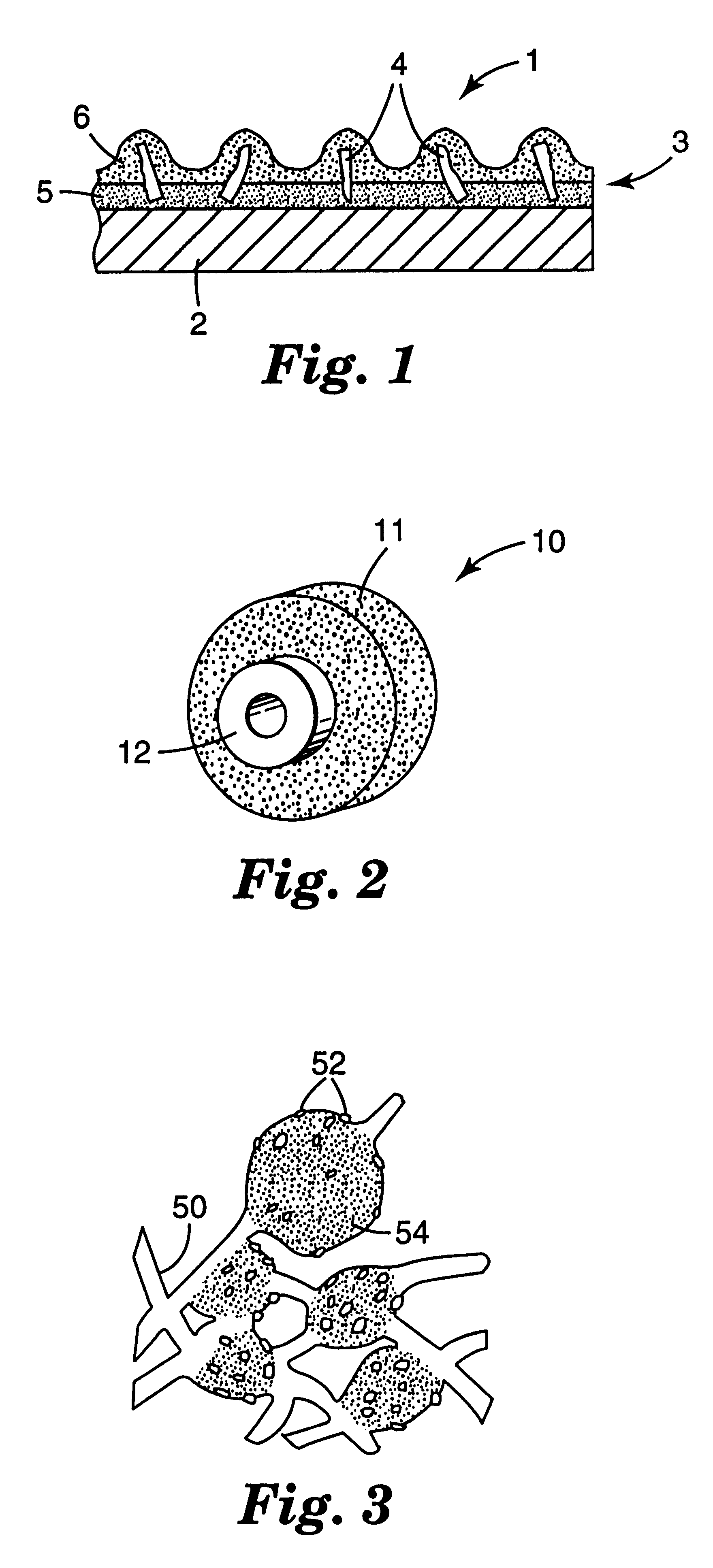 Method for making abrasive grain using impregnation, and abrasive articles