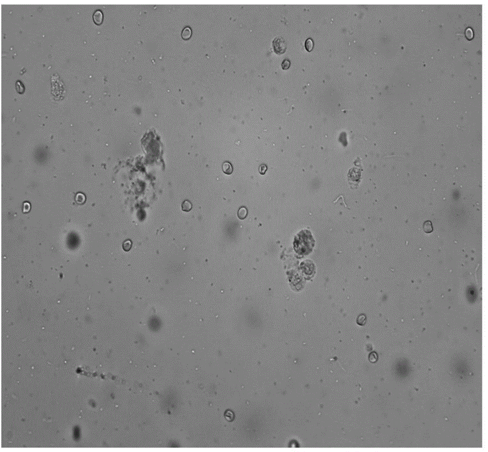 Leukocyte detecting method aiming at bronchoalveolar lavage smear