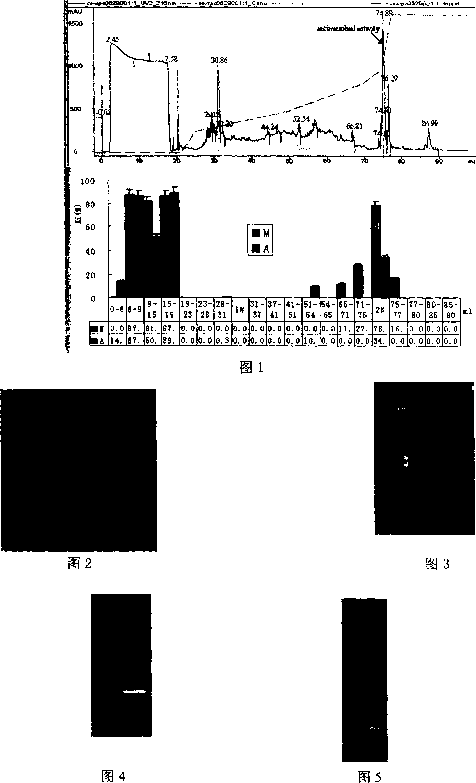 Scylla serrata antibacterial peptide and its genes and clone method for genes