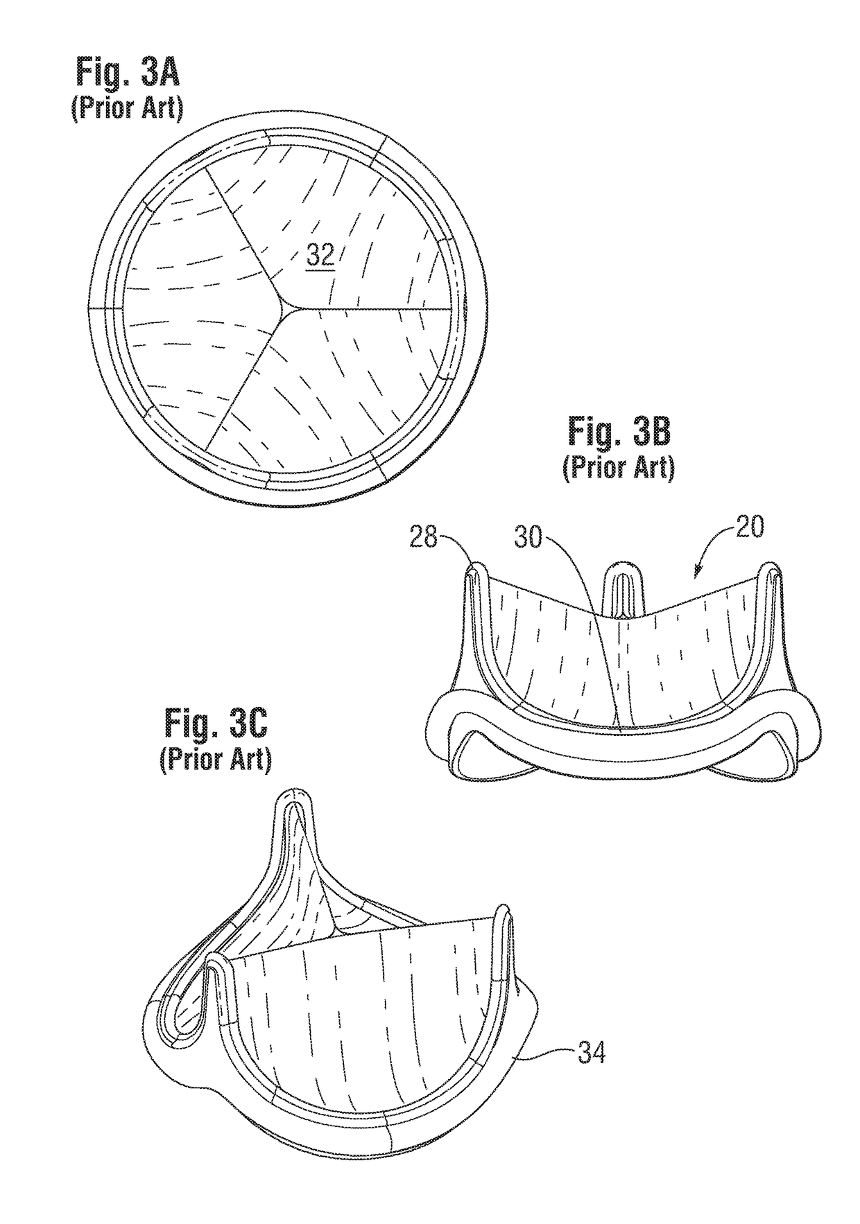 Leaflet for low gradient prosthetic heart valve