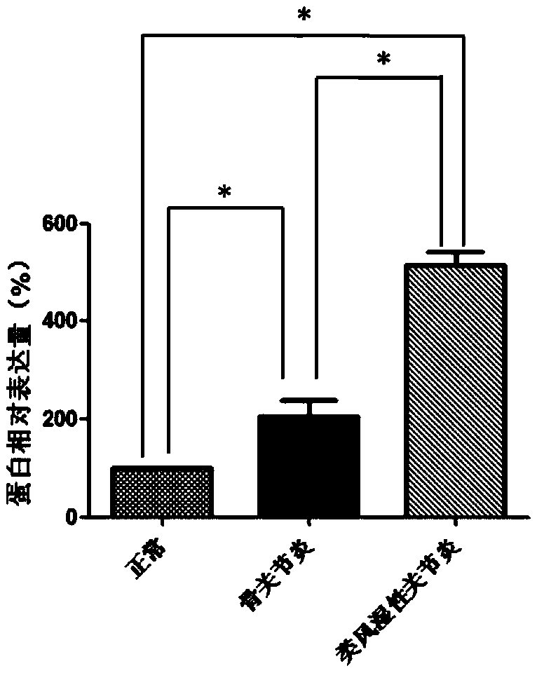 Diagnosis and treatment for rheumatoid arthritis and osteoarthritis based on SPAST gene