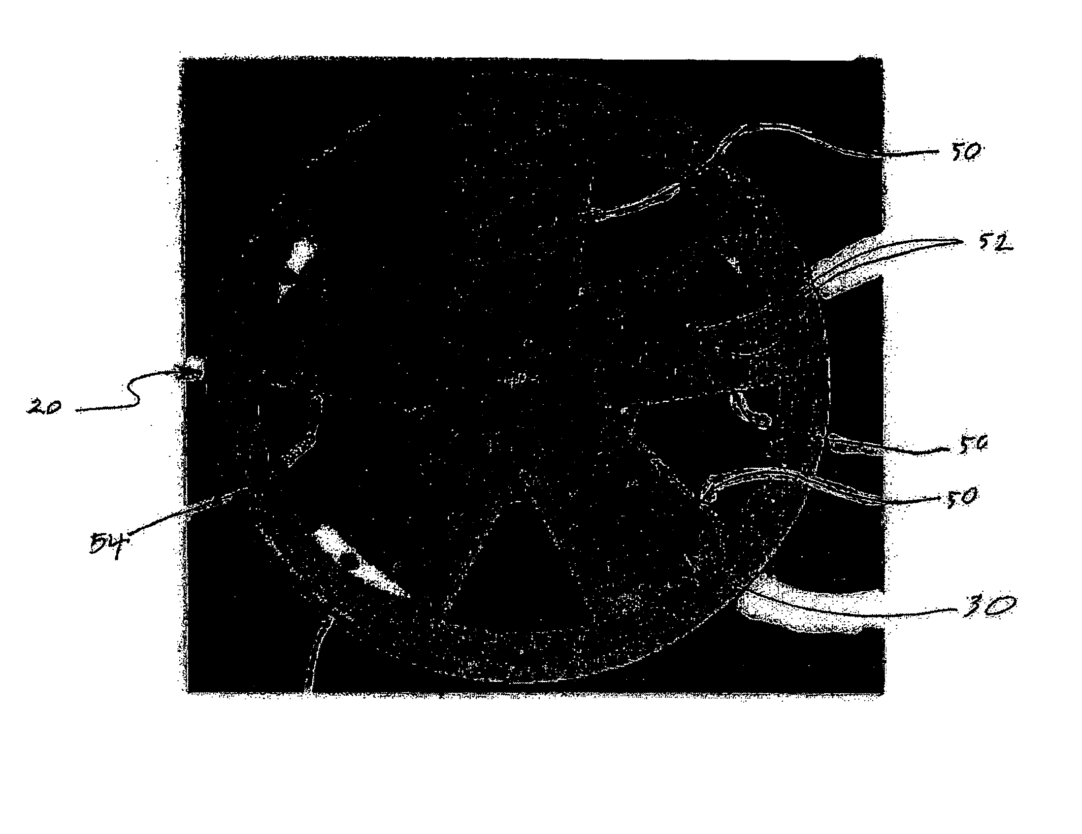 Vehicle wheel with an outer surface configured to simulate animal coverings