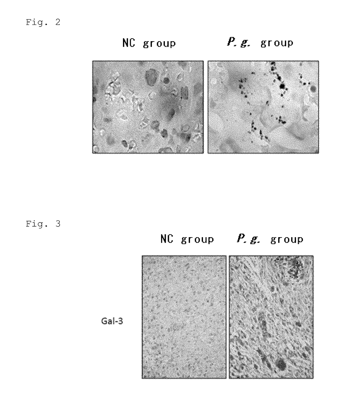 Method and Kit for Determining Risk of Preterm Birth and/or Birth of Low-Birth-Weight Baby