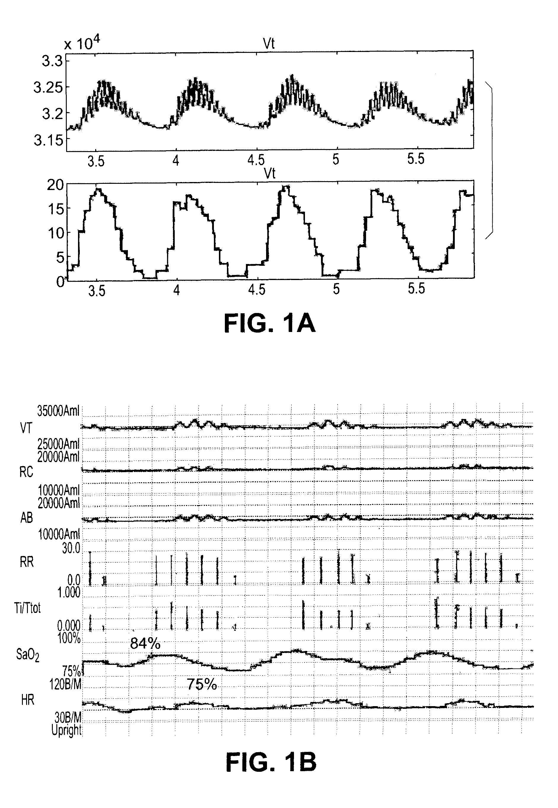 Automatic and ambulatory monitoring of congestive heart failure patients