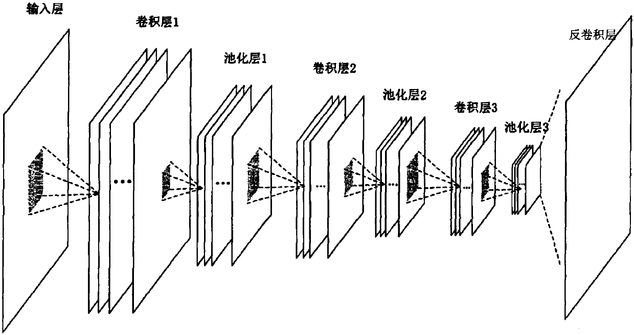 Bone image processing method, electronic device and storage medium