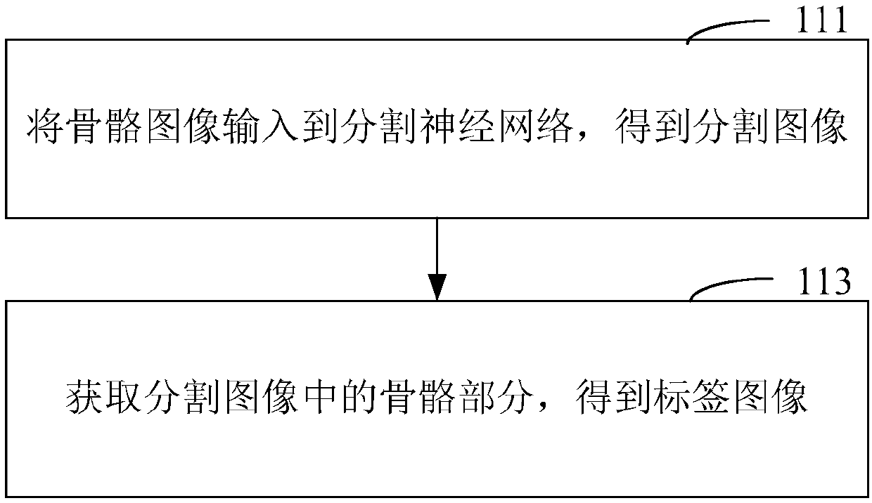 Bone image processing method, electronic device and storage medium