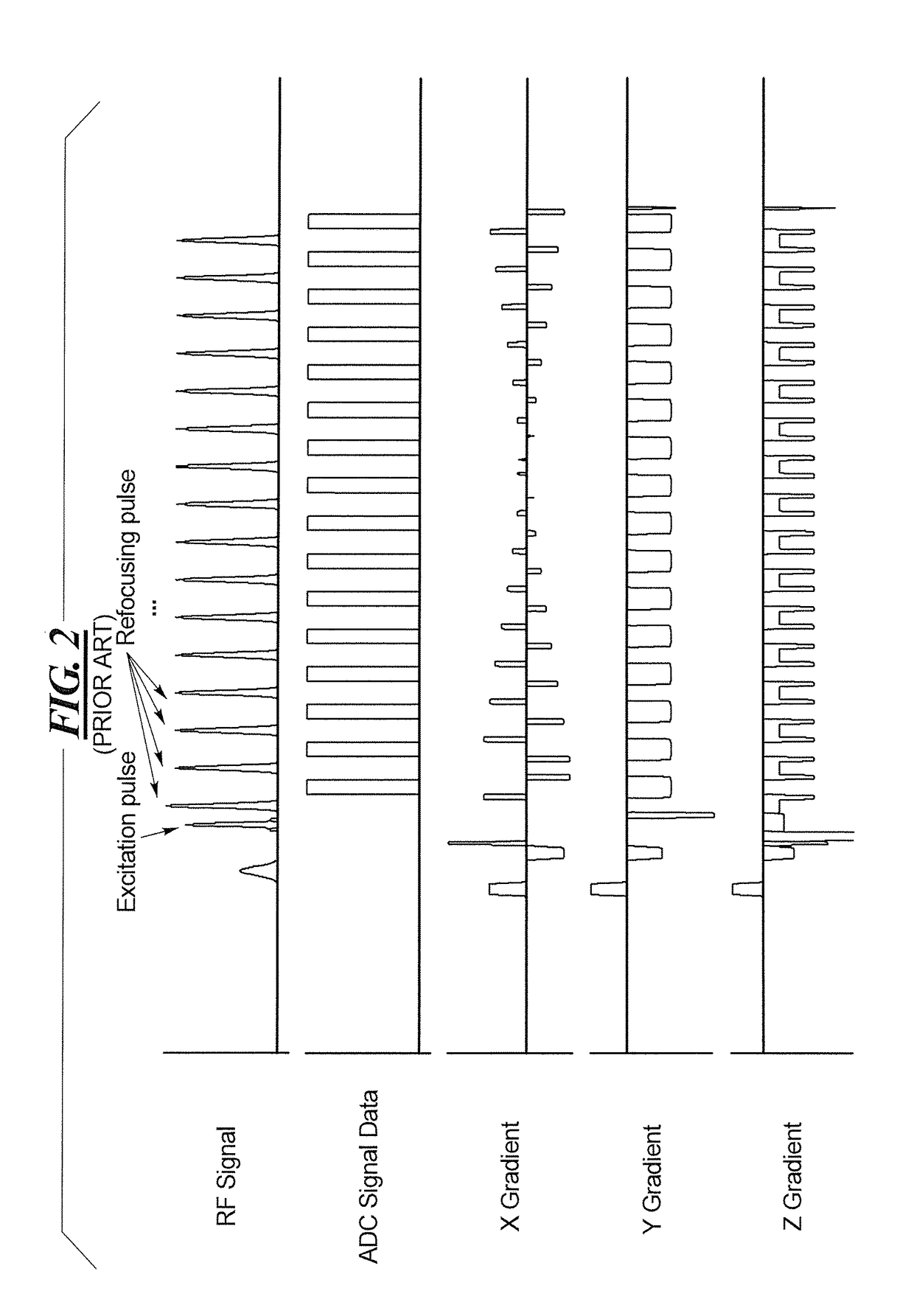 Method and magnetic resonance imaging apparatus for spatial fat suppression in multi-contrast SMS imaging