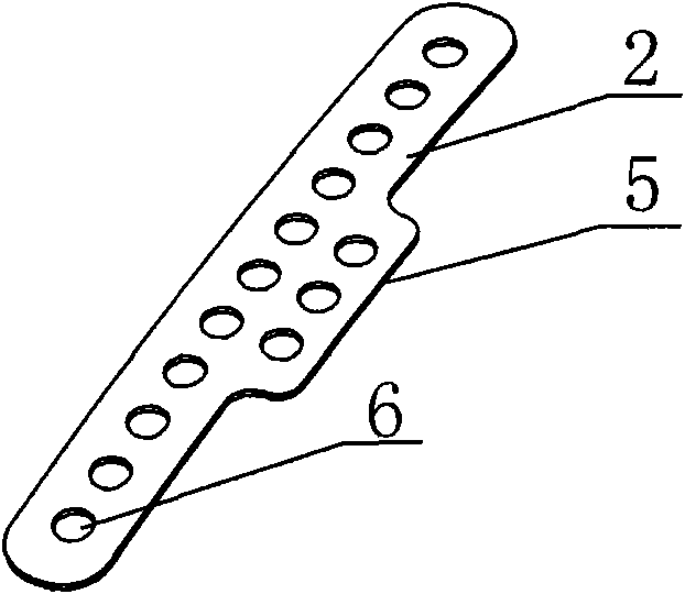 Method for fixing artificial cochlea implanting device