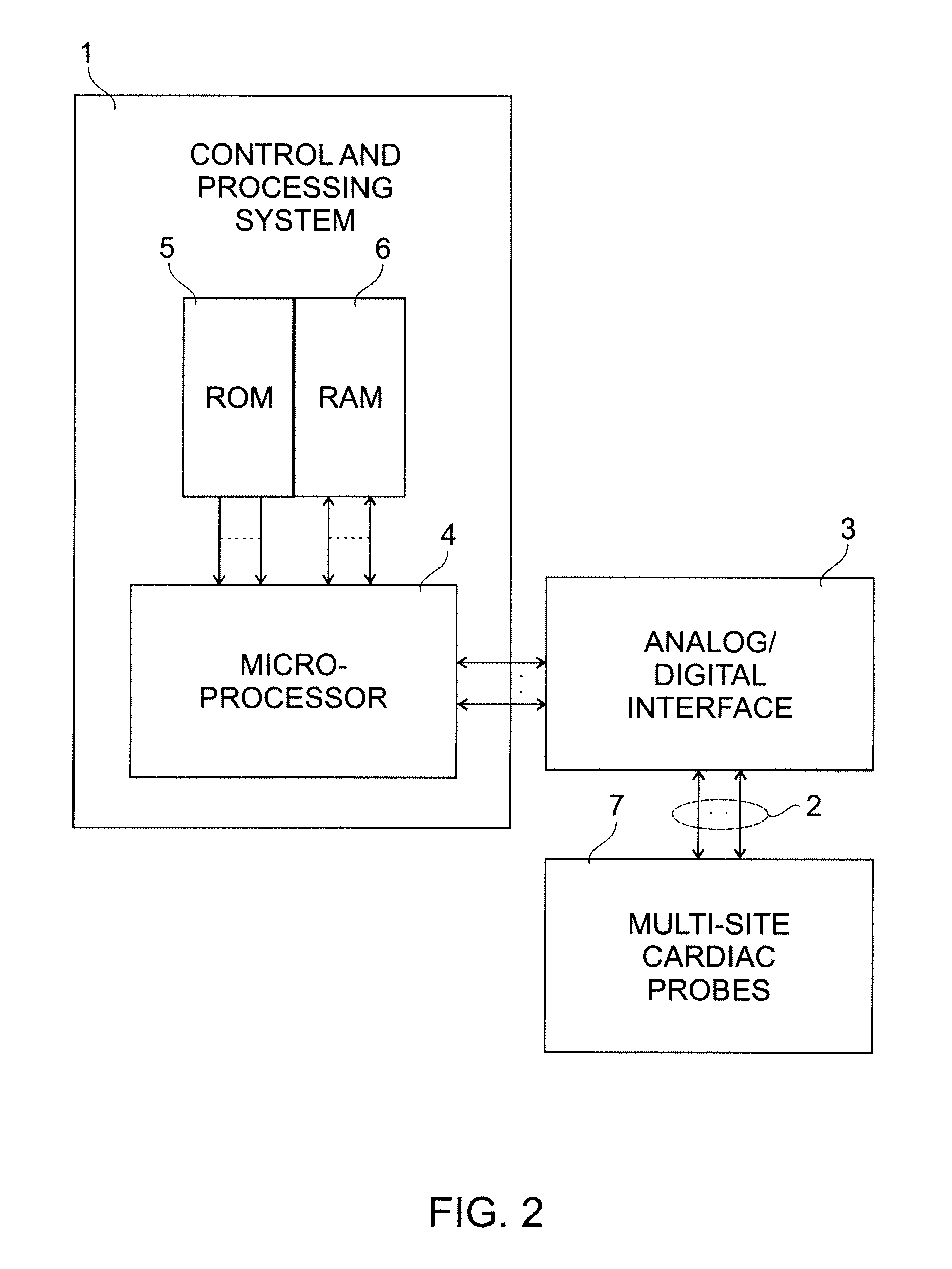 Detection, analysis and treatment of ventricular pauses in an active implantable medical device for the treatment of heartbeat rate disorders