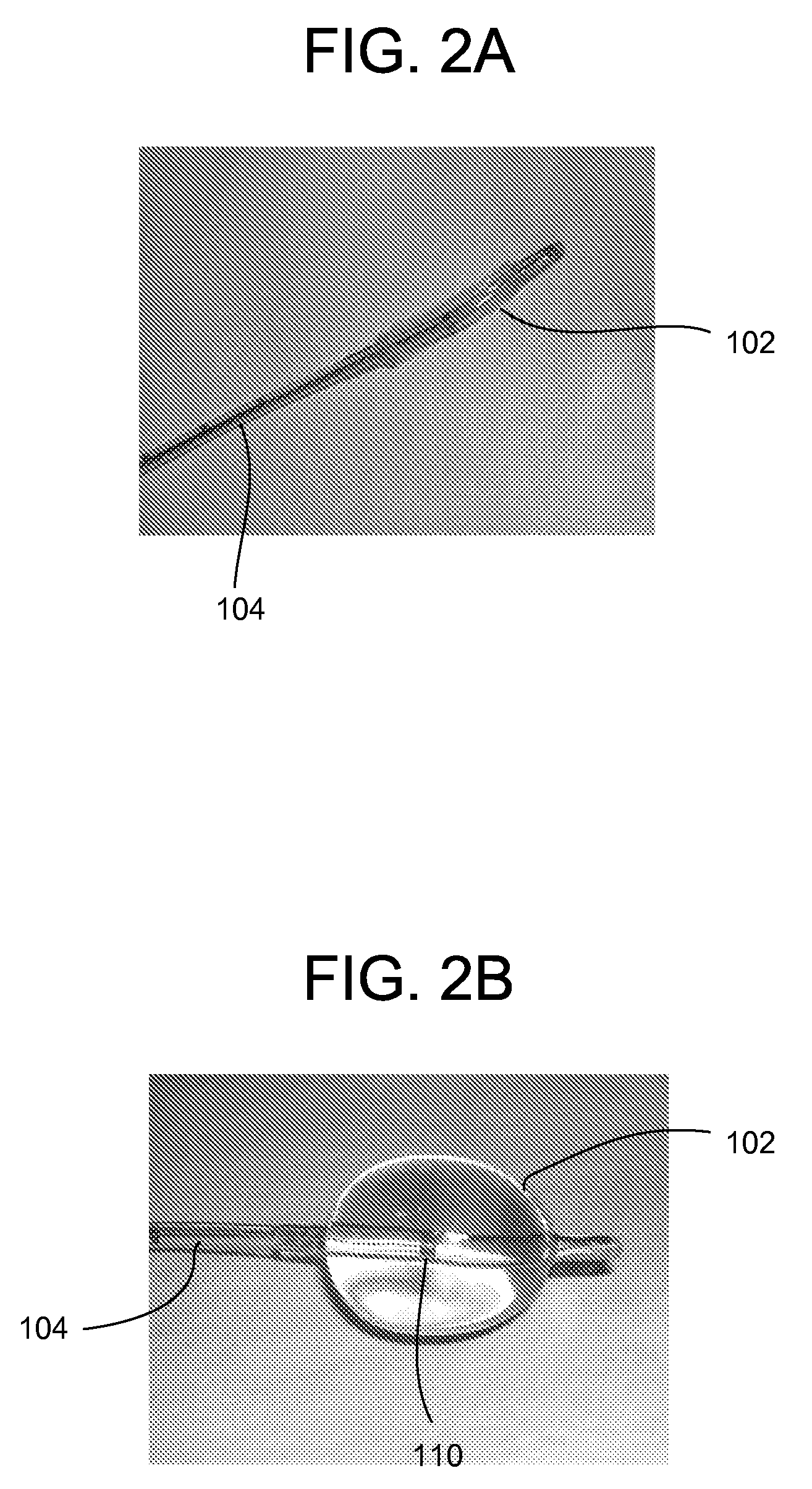 Methods and apparatus for electrical treatment using balloon and electrode