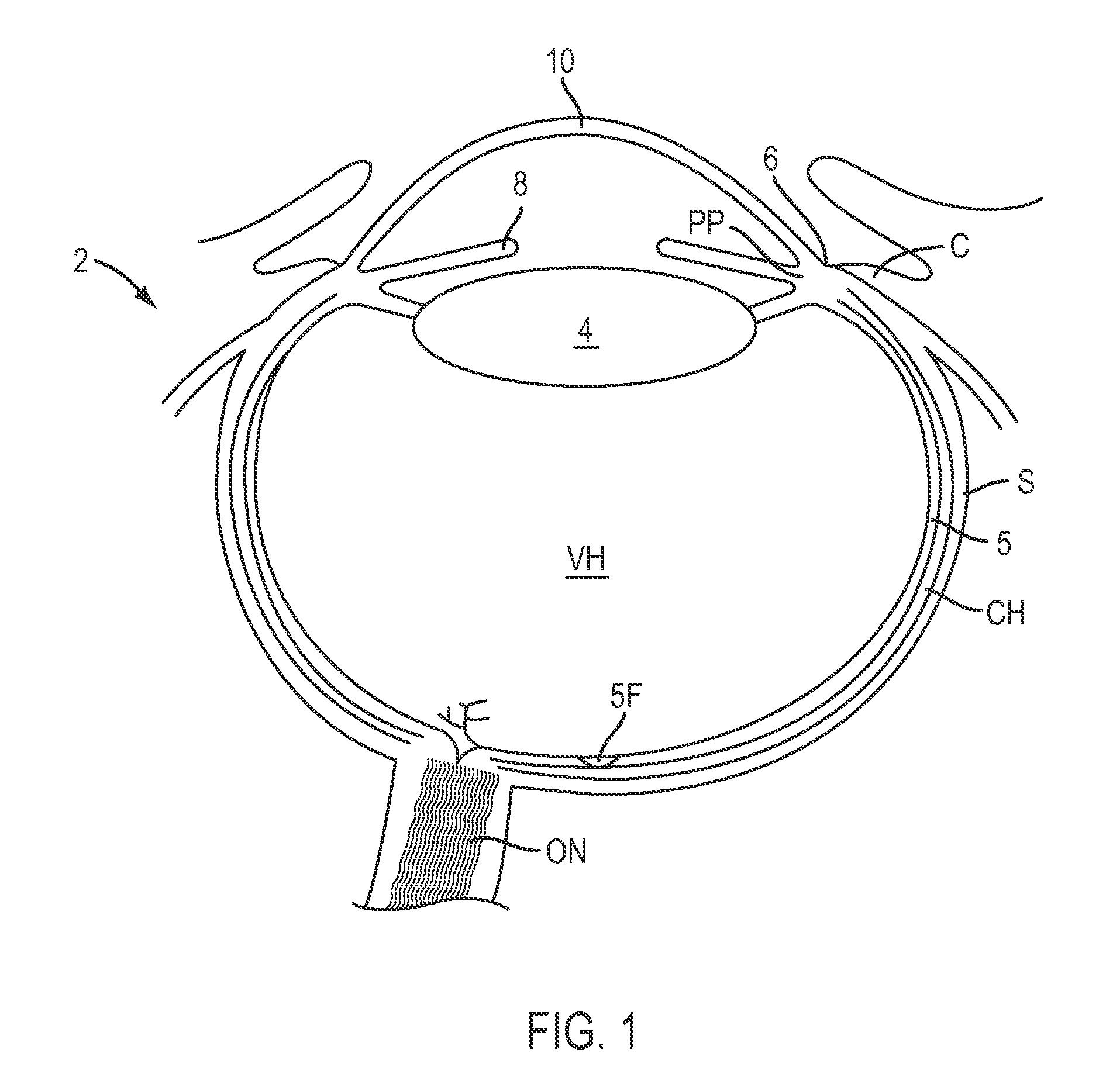 Contact lenses for refractive correction