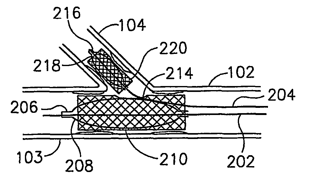 Guidewire system