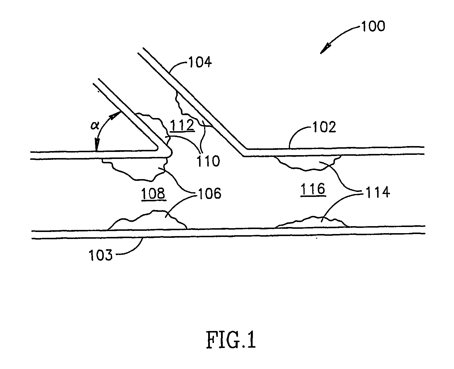 Guidewire system