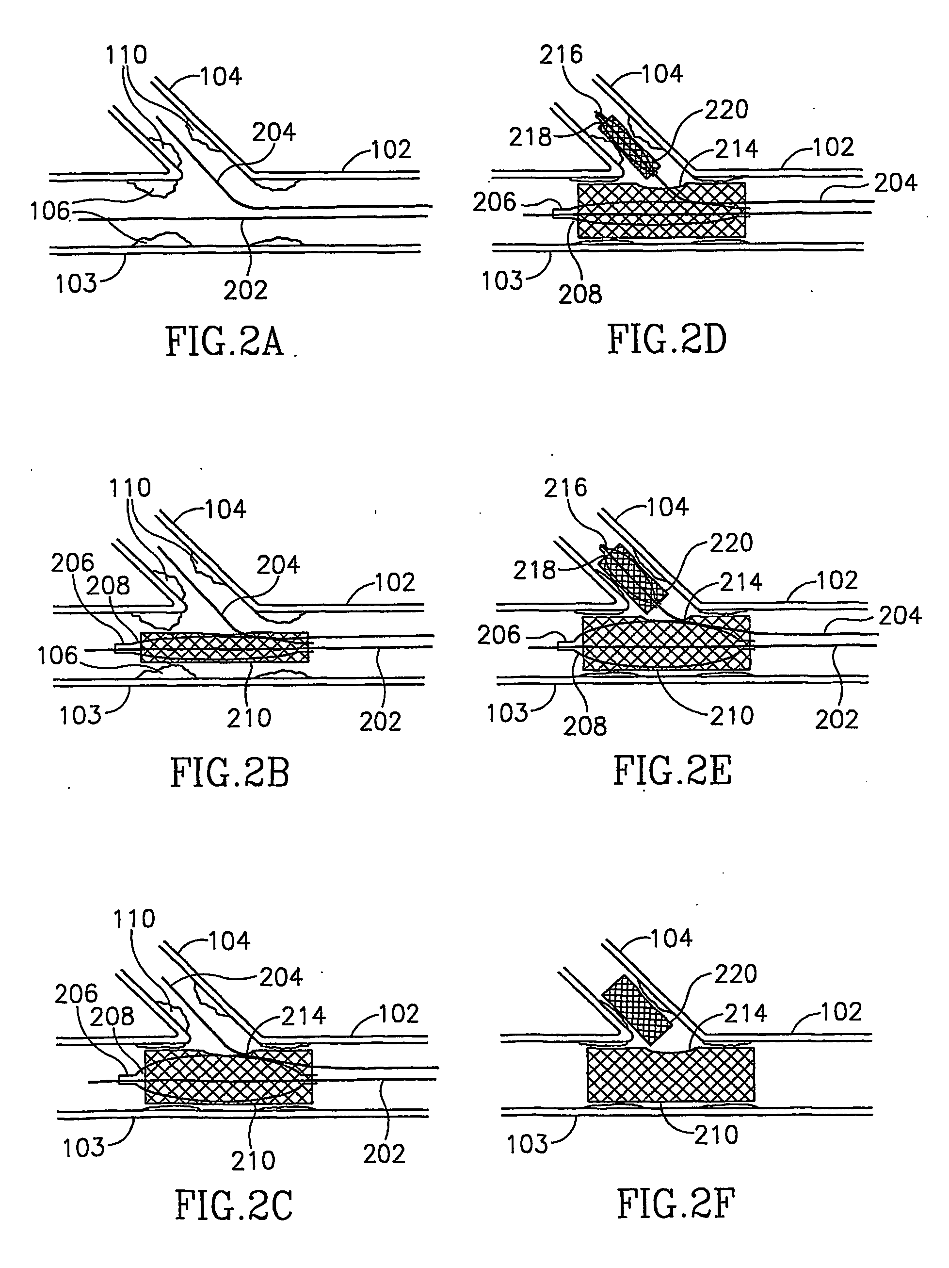 Guidewire system