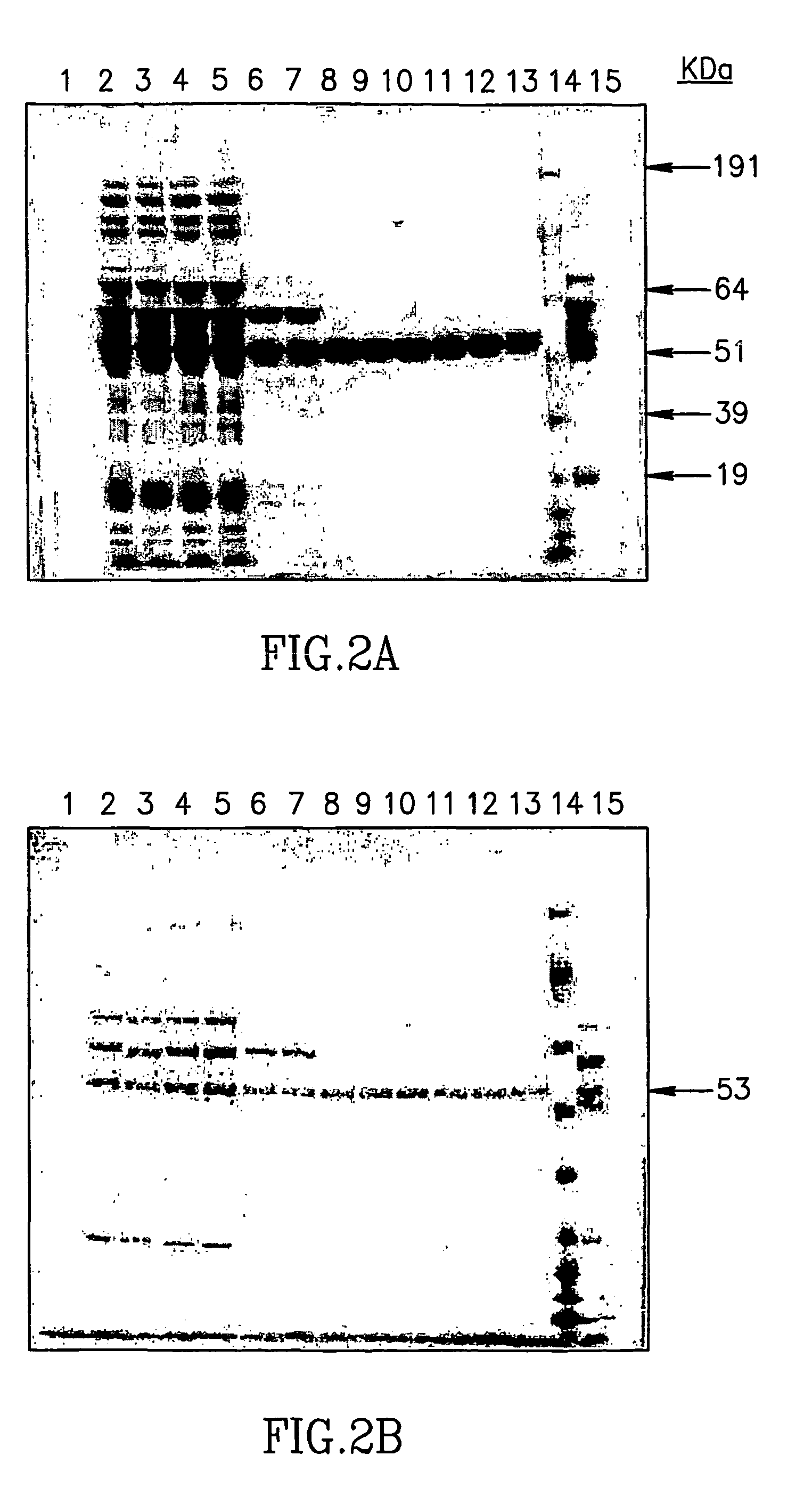 Large scale preparation of alpha-1 proteinase inhibitor and use thereof