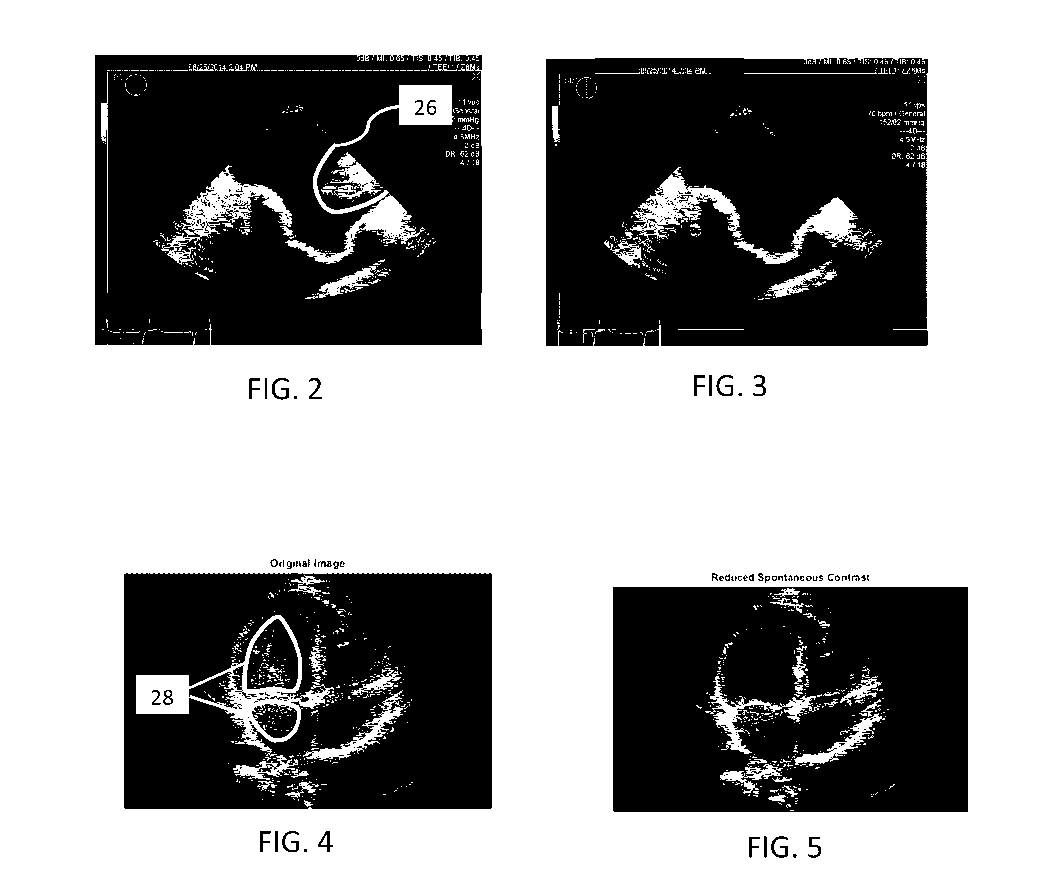 Knowledge-based ultrasound image enhancement