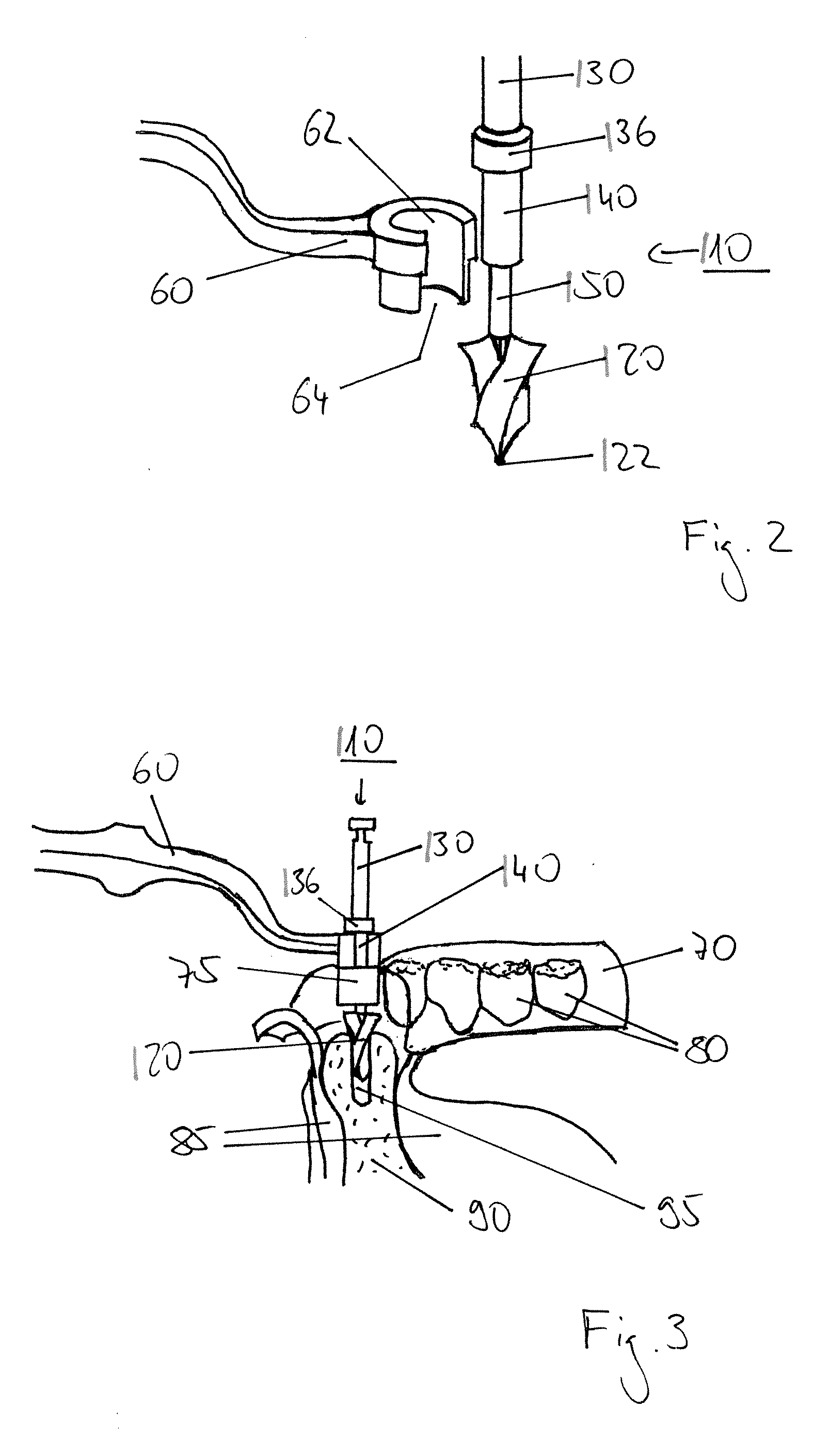 Set of dental drills