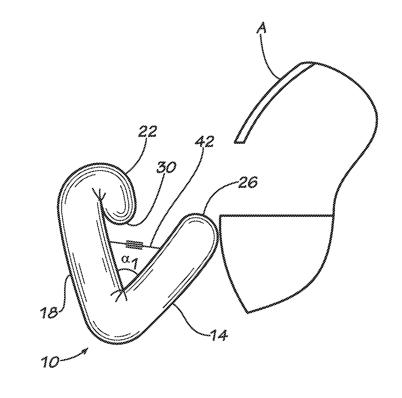 Restraints principally for inflatable evacuation systems