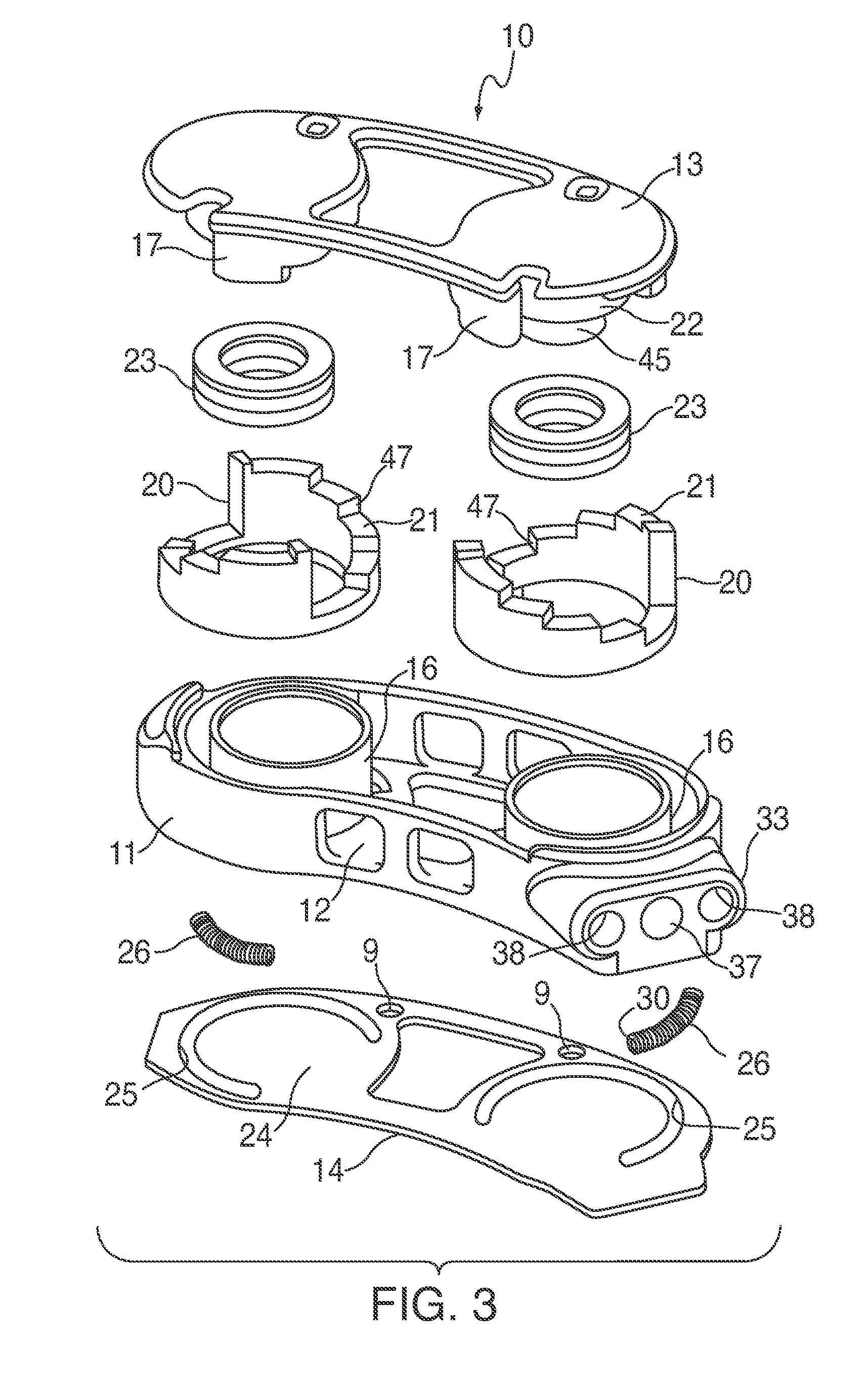 Adjustable Distraction Cage With Linked Locking Mechanisms