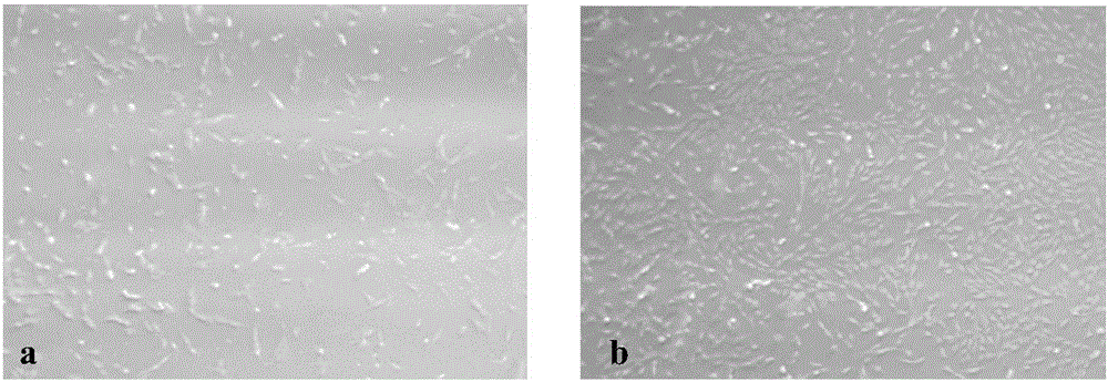 Culture method of deciduous tooth pulp stem cells