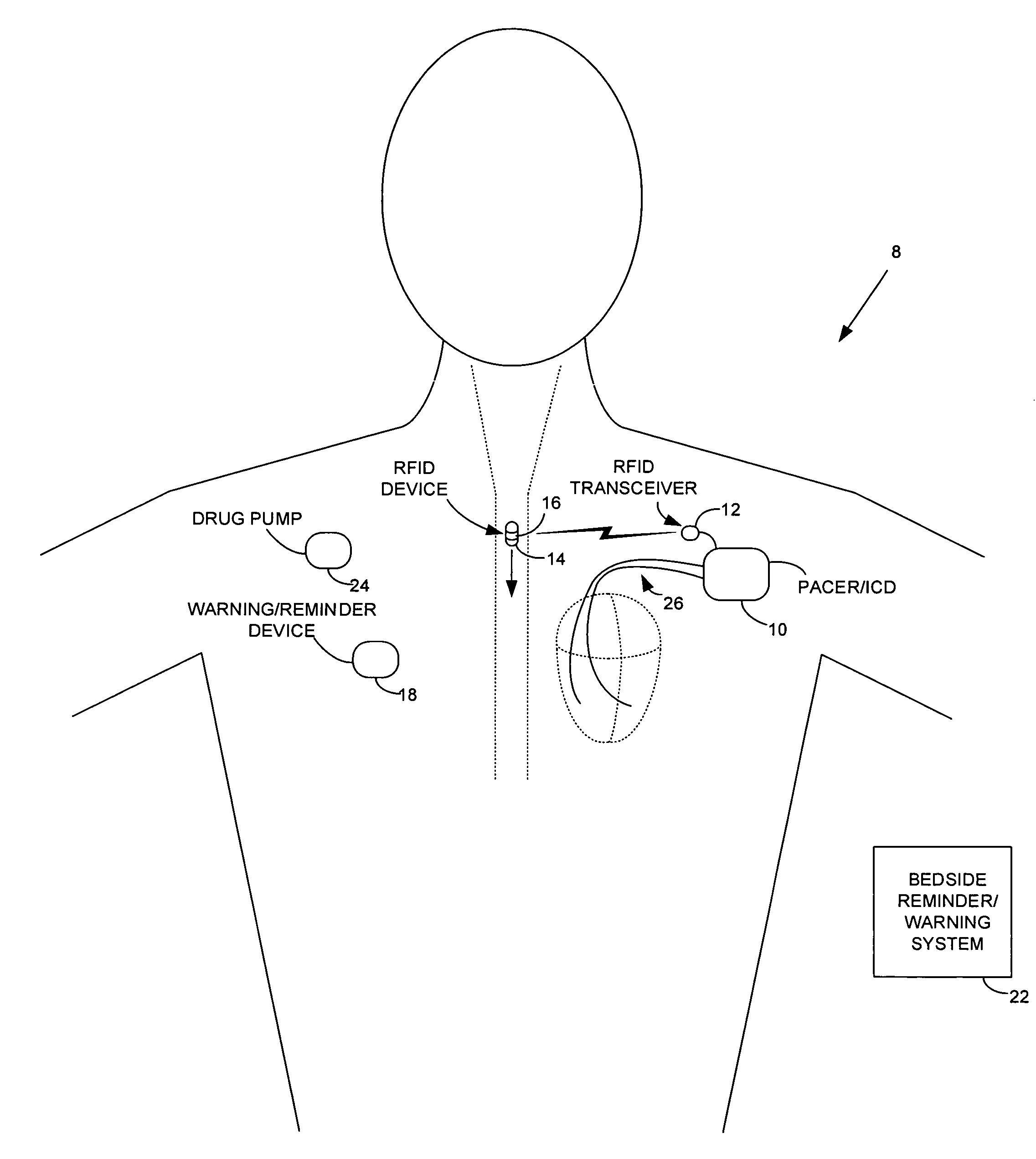 Method and apparatus for monitoring ingestion of medications using an implantable medical device