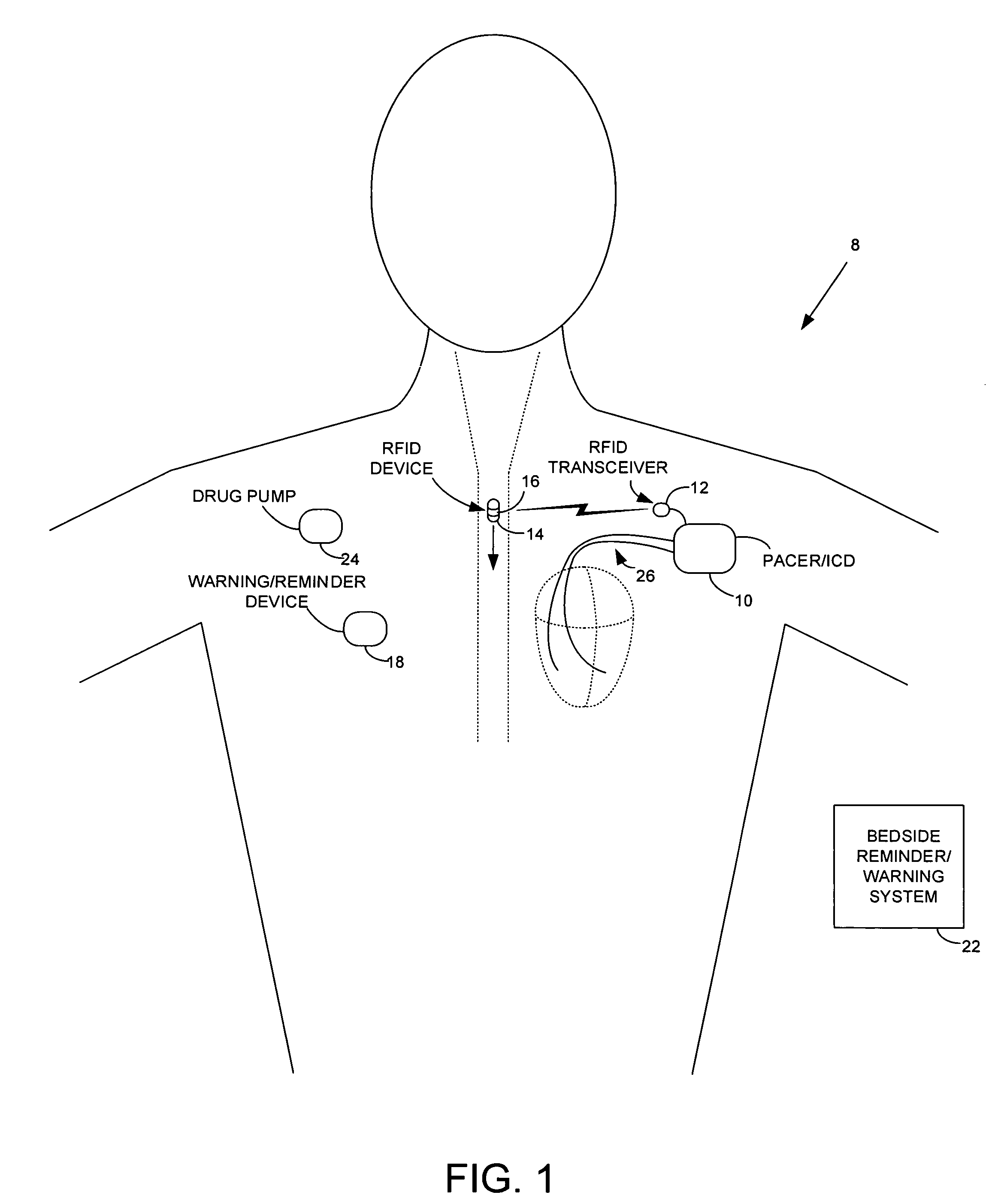 Method and apparatus for monitoring ingestion of medications using an implantable medical device