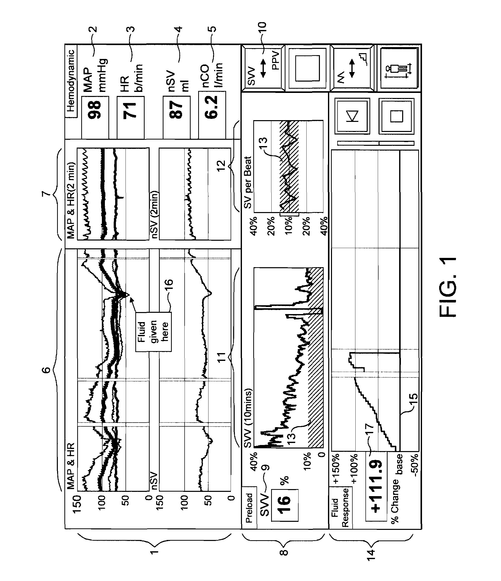 Patient monitoring