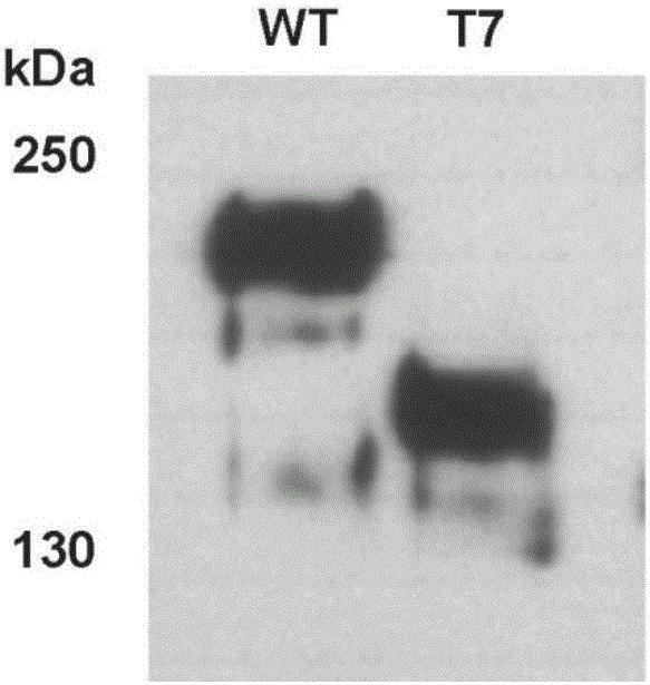 Inhibitory monoclonal antibody resistant to lyase of human von Willebrand factor (VWF) and application of inhibitory monoclonal antibody