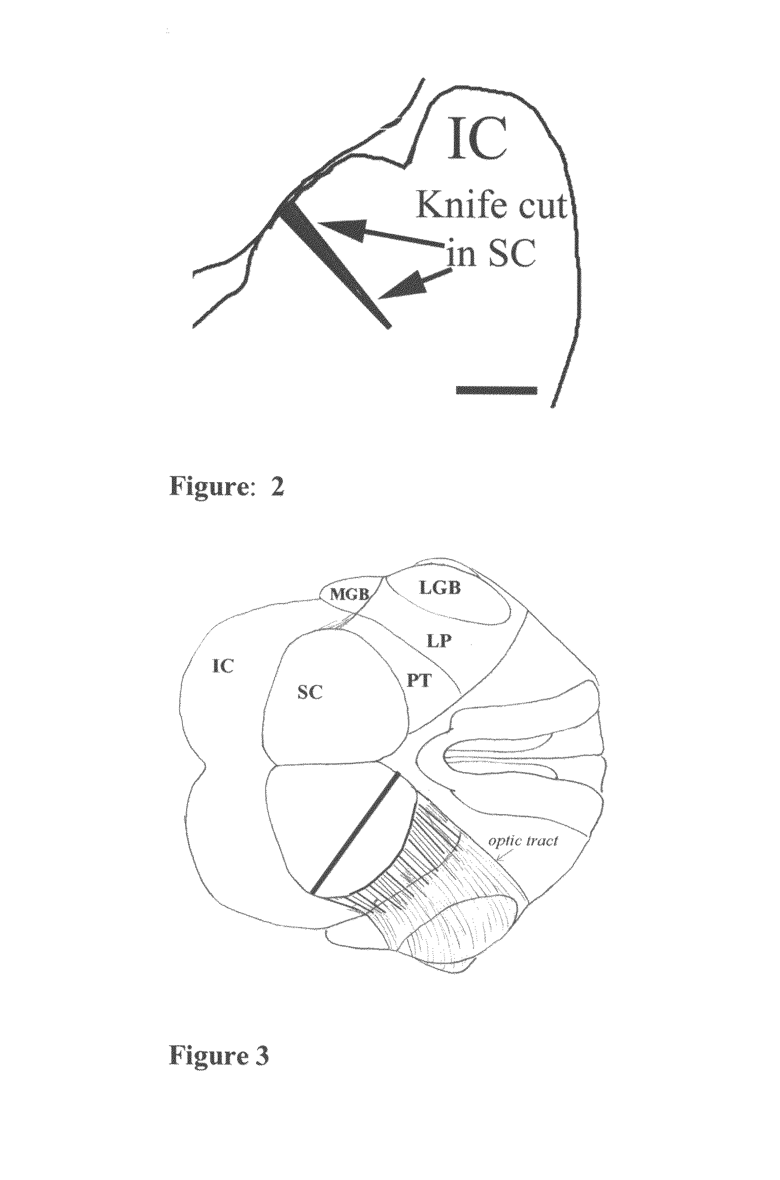 Self-assembling peptides for regeneration and repair of neural tissue