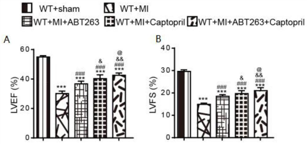 Application of ABT-263 combined angiotensin converting enzyme inhibitor and product of ABT-263 combined angiotensin converting enzyme inhibitor