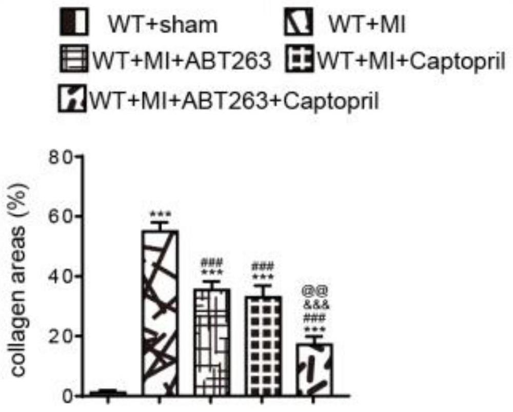 Application of ABT-263 combined angiotensin converting enzyme inhibitor and product of ABT-263 combined angiotensin converting enzyme inhibitor