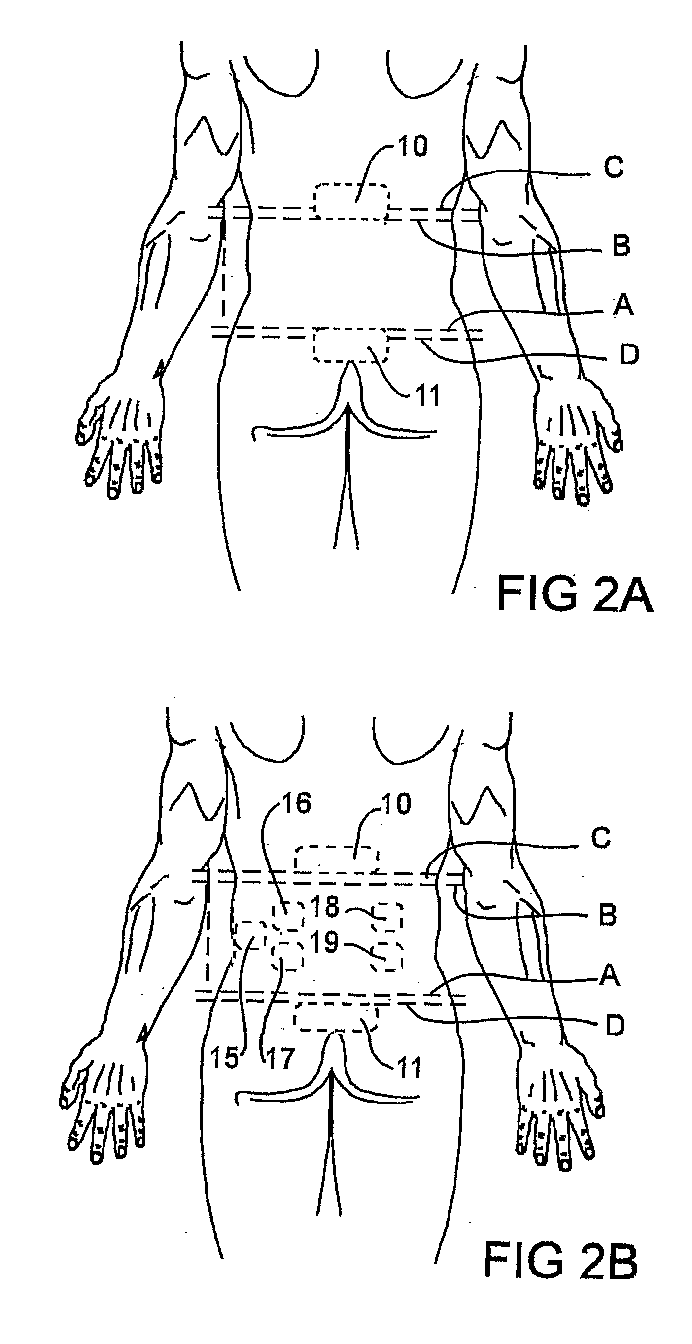 Apparatus and Method for Monitoring and/or Load Applied to a Mammal