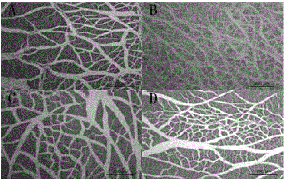 Application of fucoidan to preparing products for preventing and/or treating lower limb peripheral artery vascular diseases