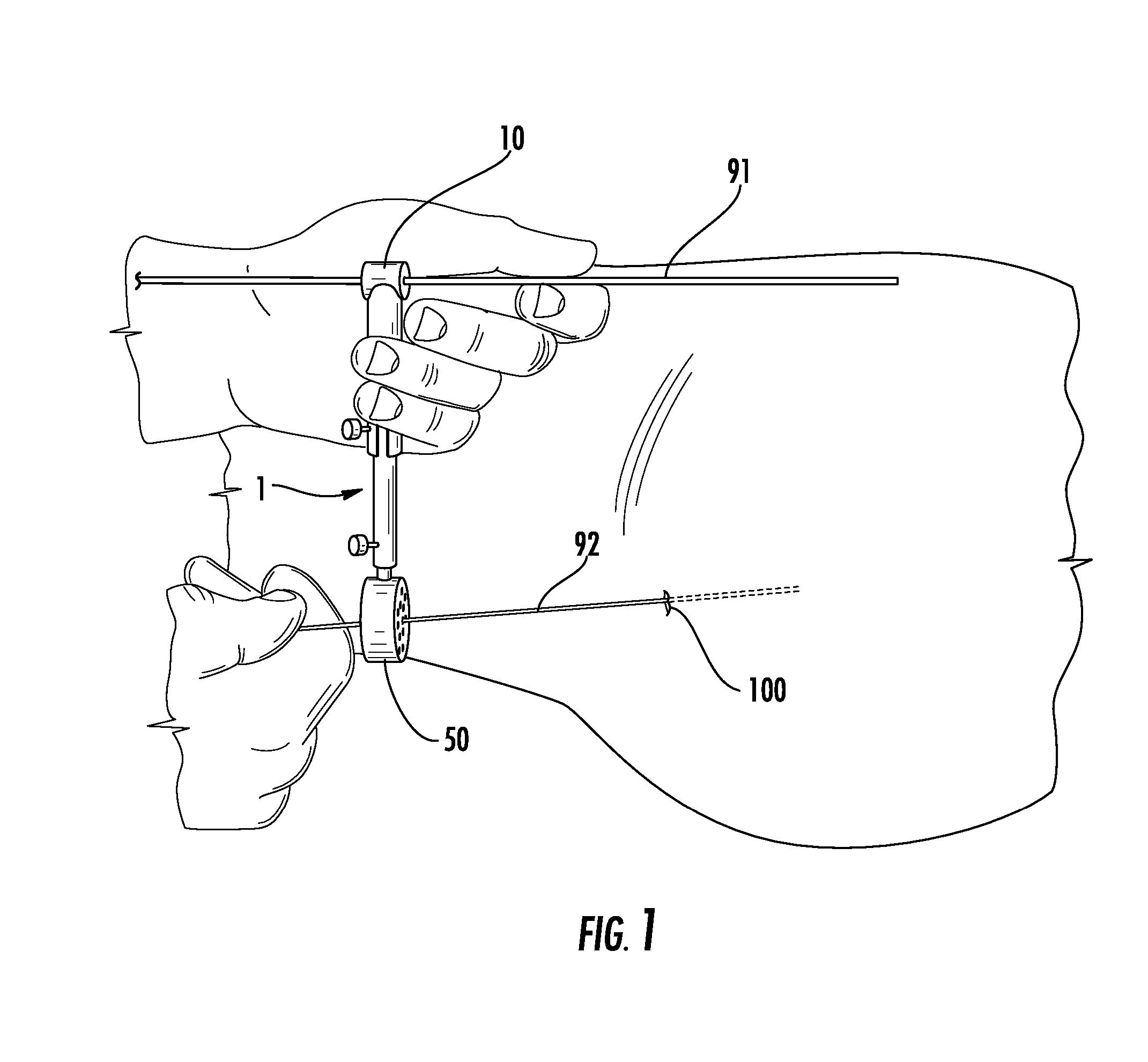 Guide pin placement for hip resurfacing