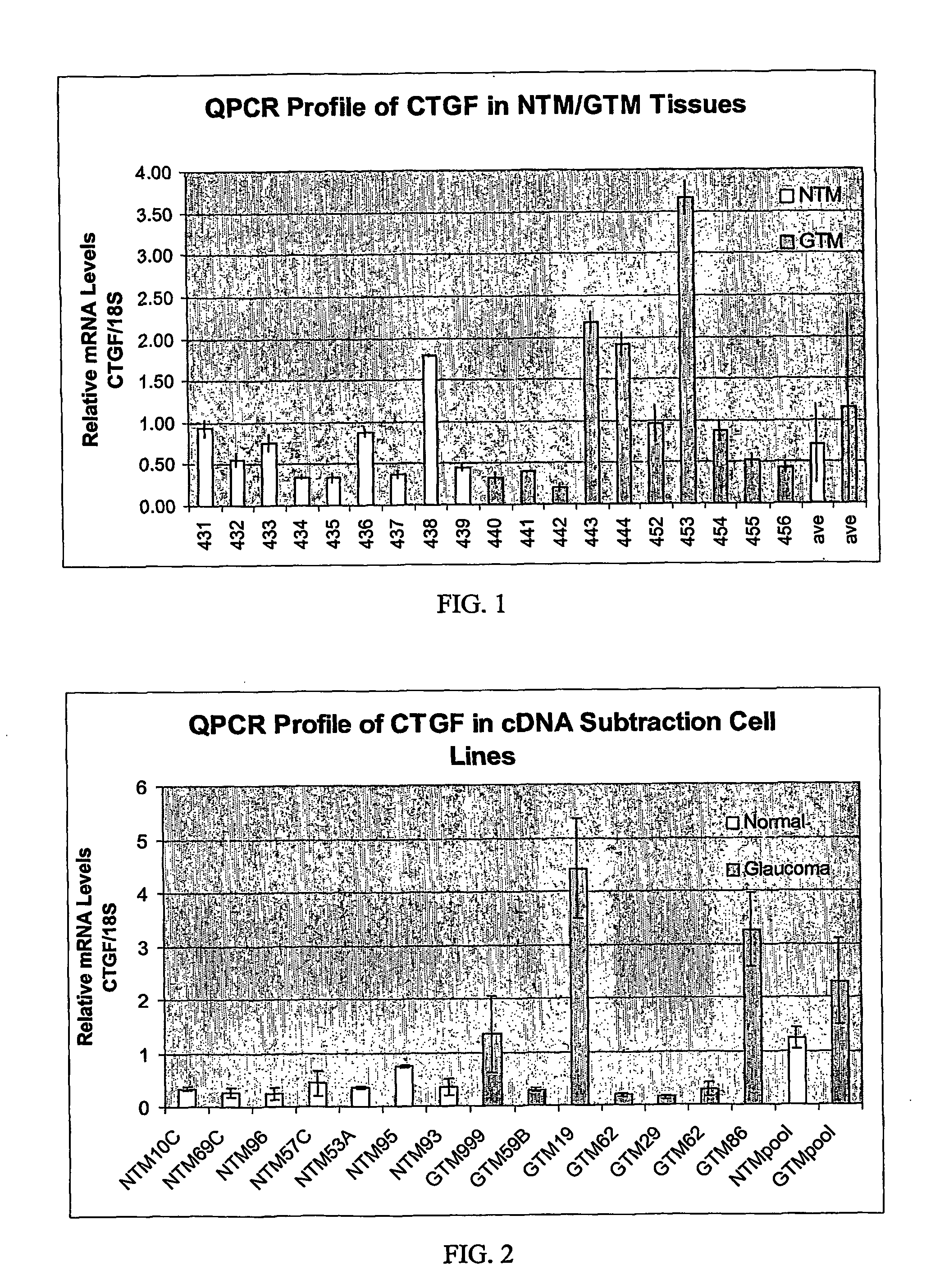 Agents which regulate, inhibit, or modulate the activity and/or expression of connective tissue growth factor (ctgf) as a unique means to both lower intraocular pressure and treat glaucomatous retinopathies/optic neuropathies