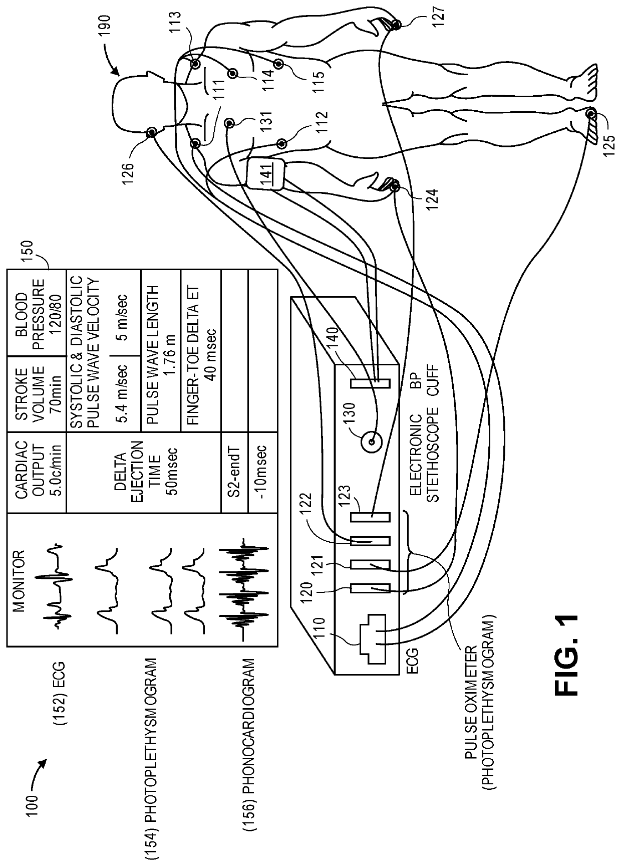 Device and method to measure ventricular arterial coupling and vascular performance