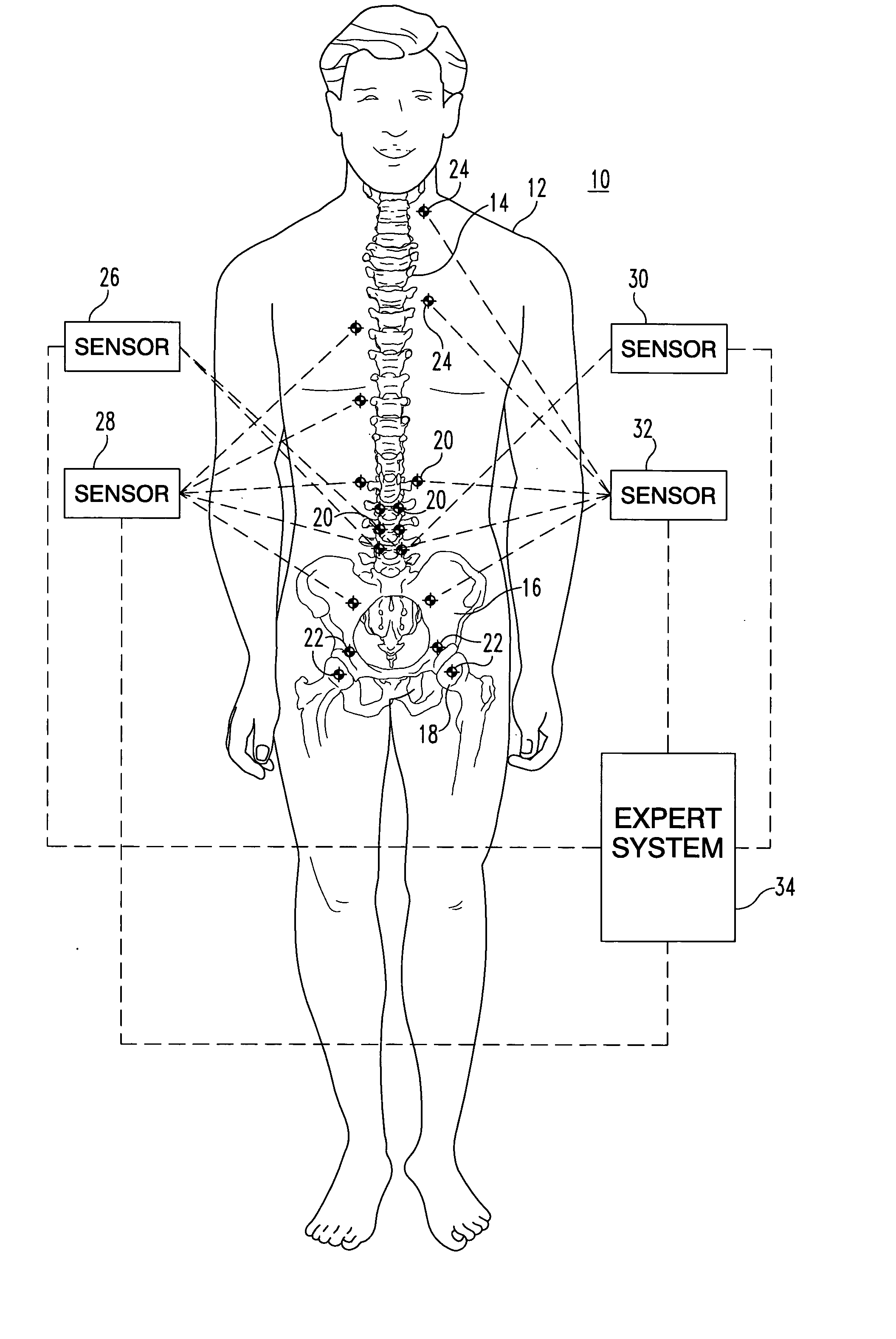 Method and apparatus for expert system to track and manipulate patients