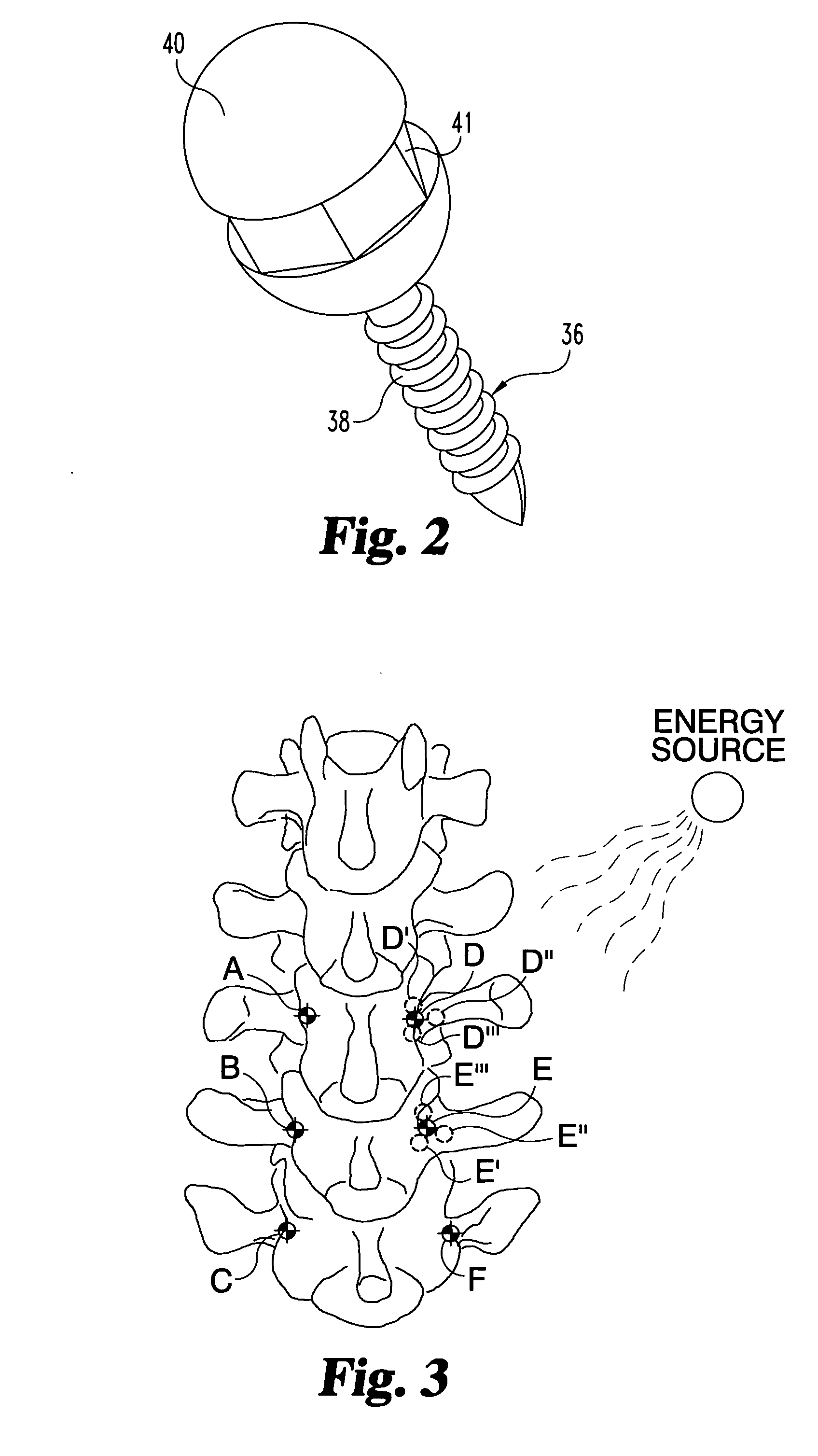 Method and apparatus for expert system to track and manipulate patients