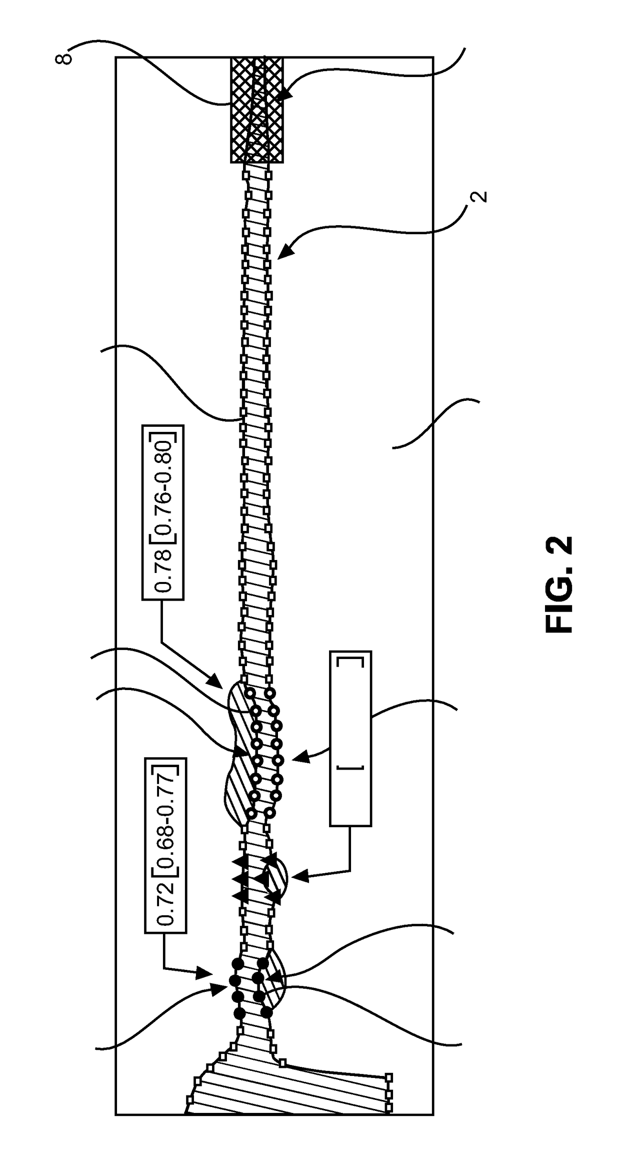 Segmentation apparatus for interactively segmenting blood vessels in angiographic image data