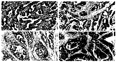 Gastric cancer prognosis predictive marker and application thereof