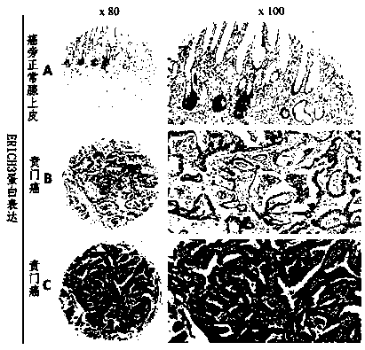 Gastric cancer prognosis predictive marker and application thereof