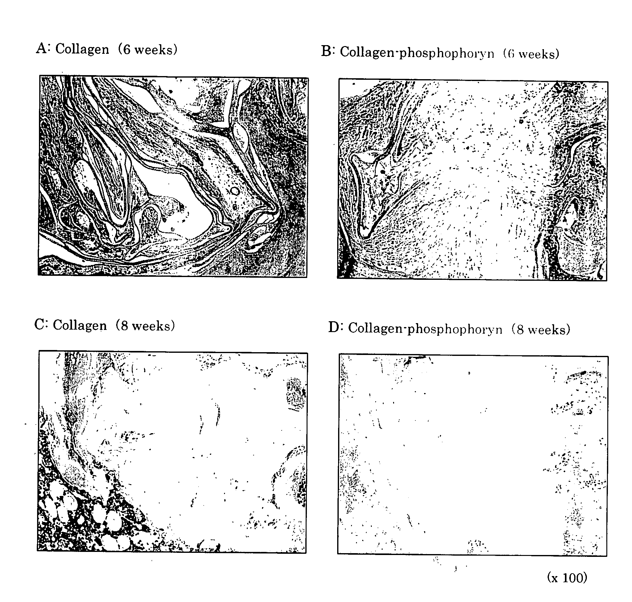 Composite biomaterial comprising phospholine