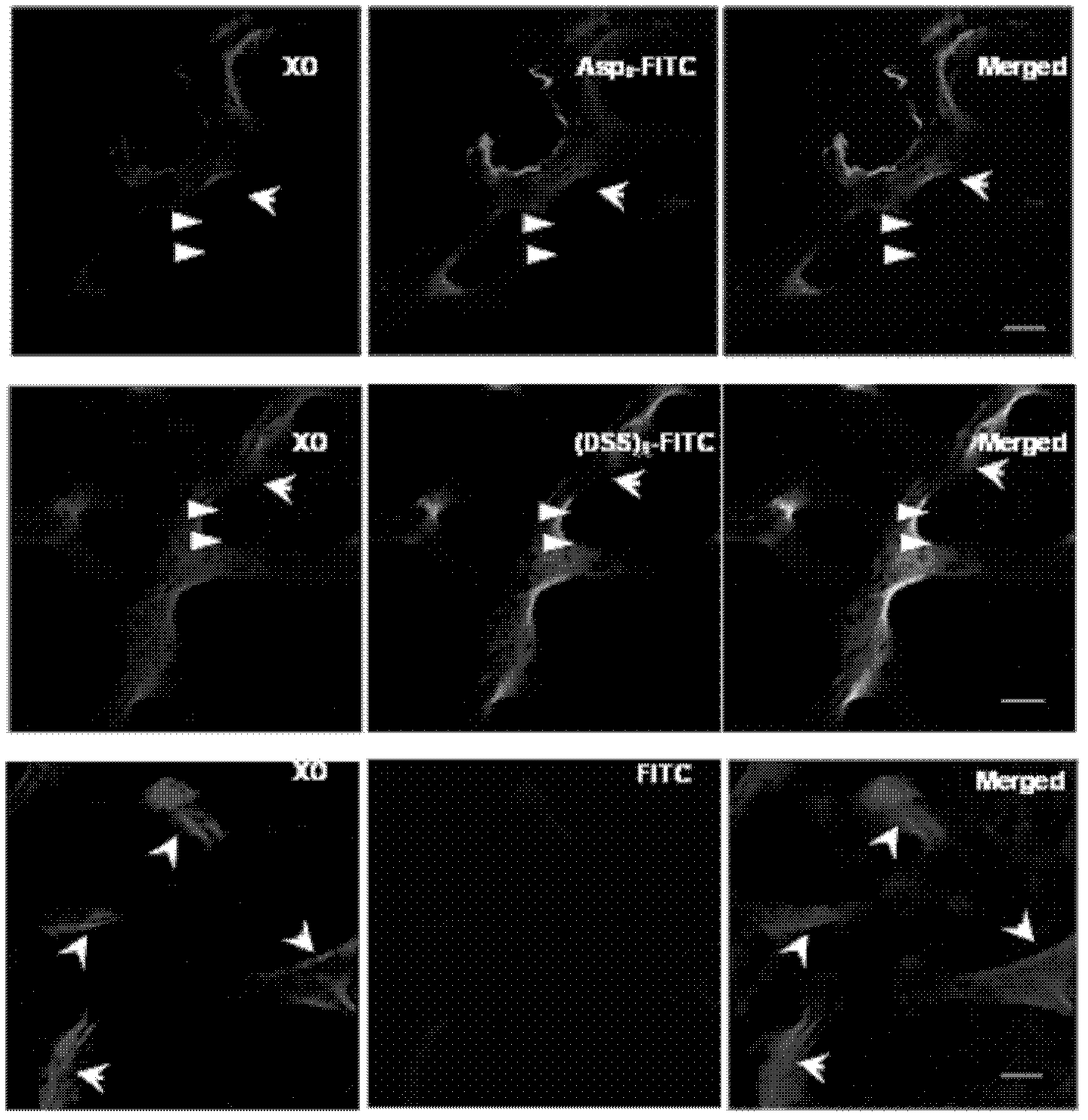 Bone-targeted delivery system for osteogenesis treatment based on small nucleic acid medicine, and preparation method thereof