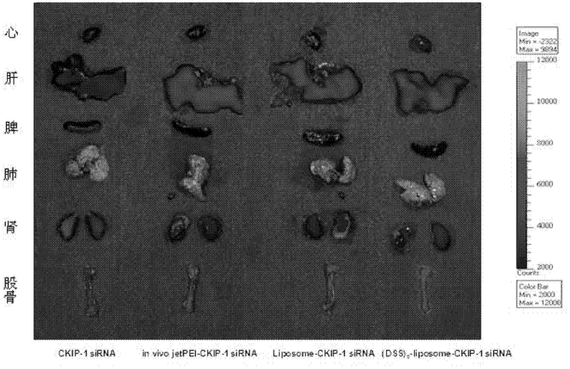 Bone-targeted delivery system for osteogenesis treatment based on small nucleic acid medicine, and preparation method thereof