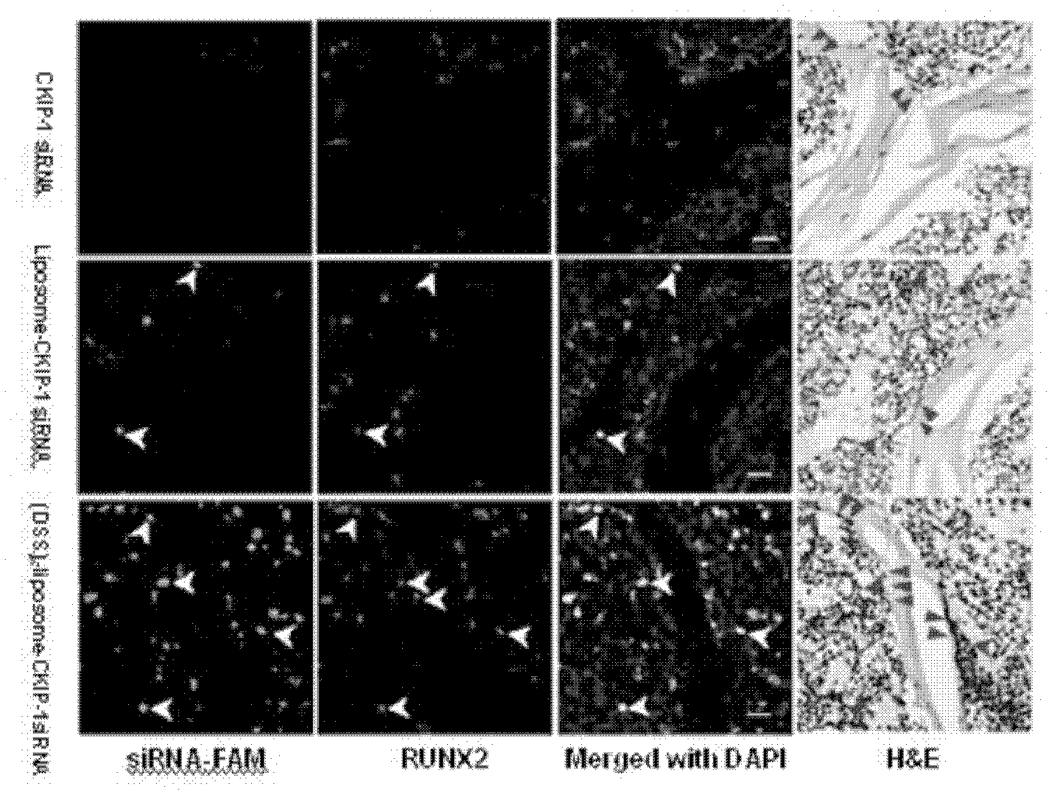 Bone-targeted delivery system for osteogenesis treatment based on small nucleic acid medicine, and preparation method thereof