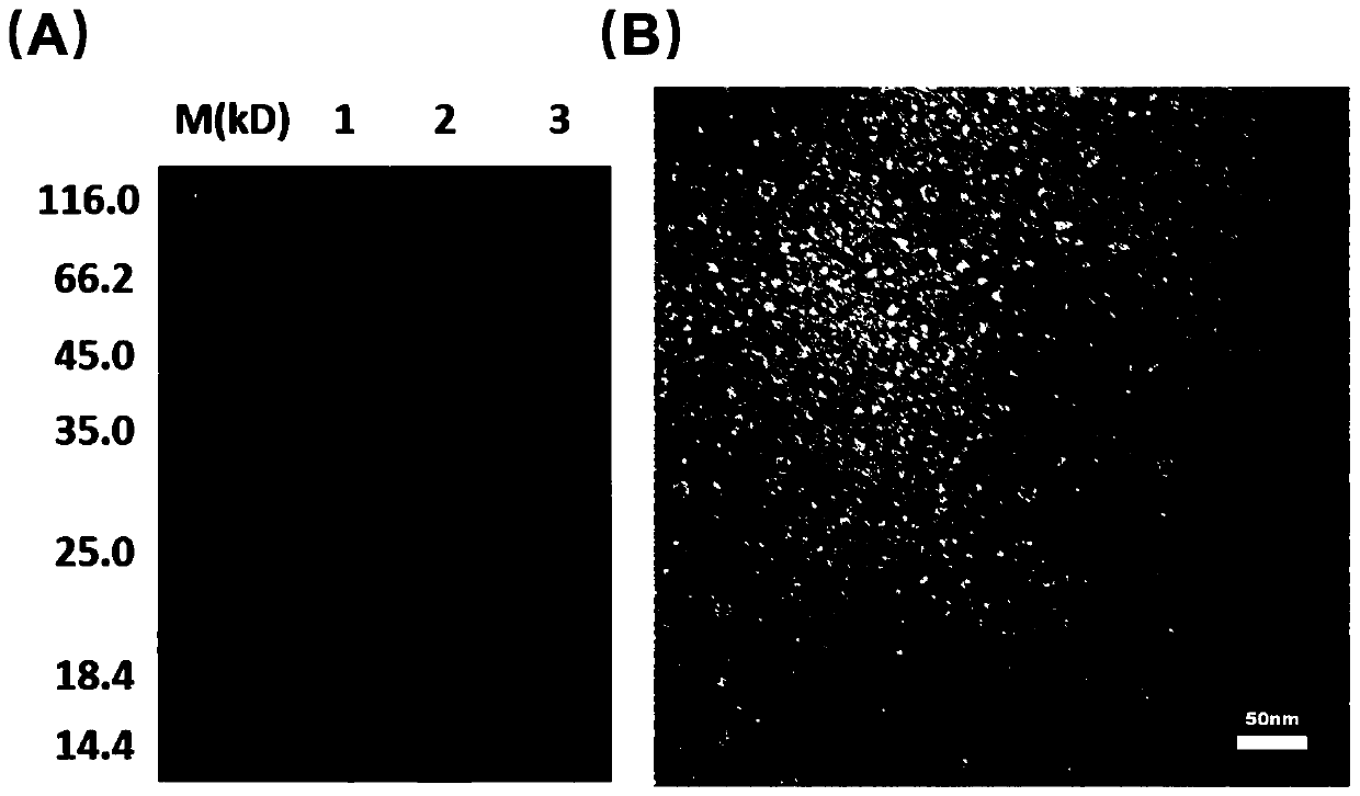 Preparation method and application of heat-resistant ferritin