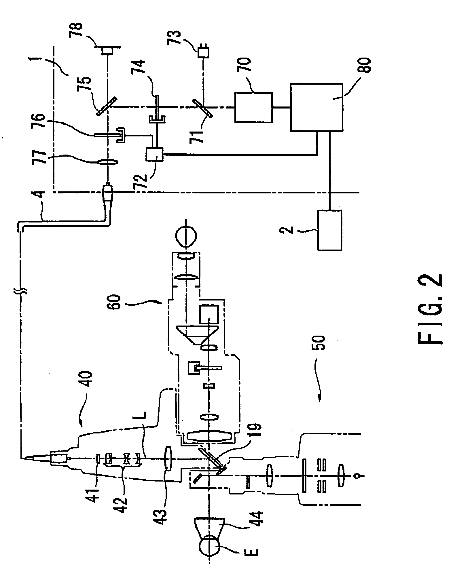 Ophthalmic laser treatment apparatus