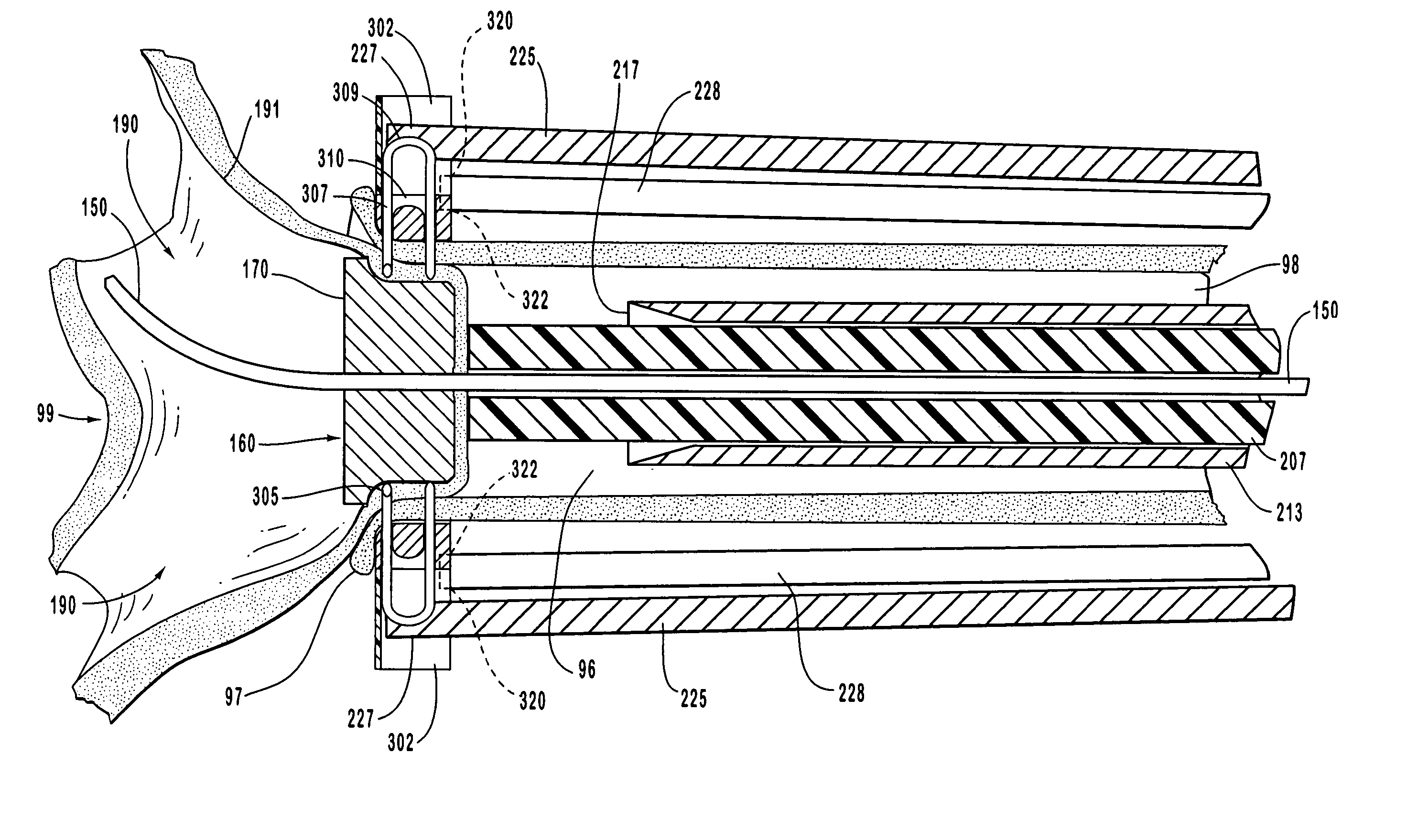 Staple and anvil anastomosis system