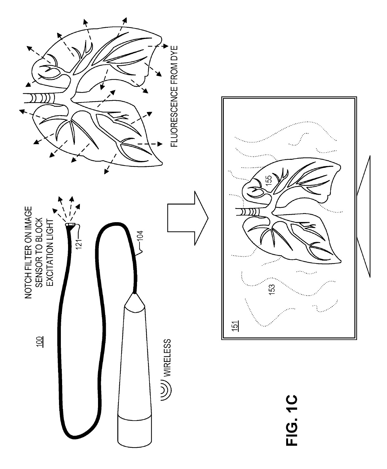 Simultaneous visible and fluorescence endoscopic imaging